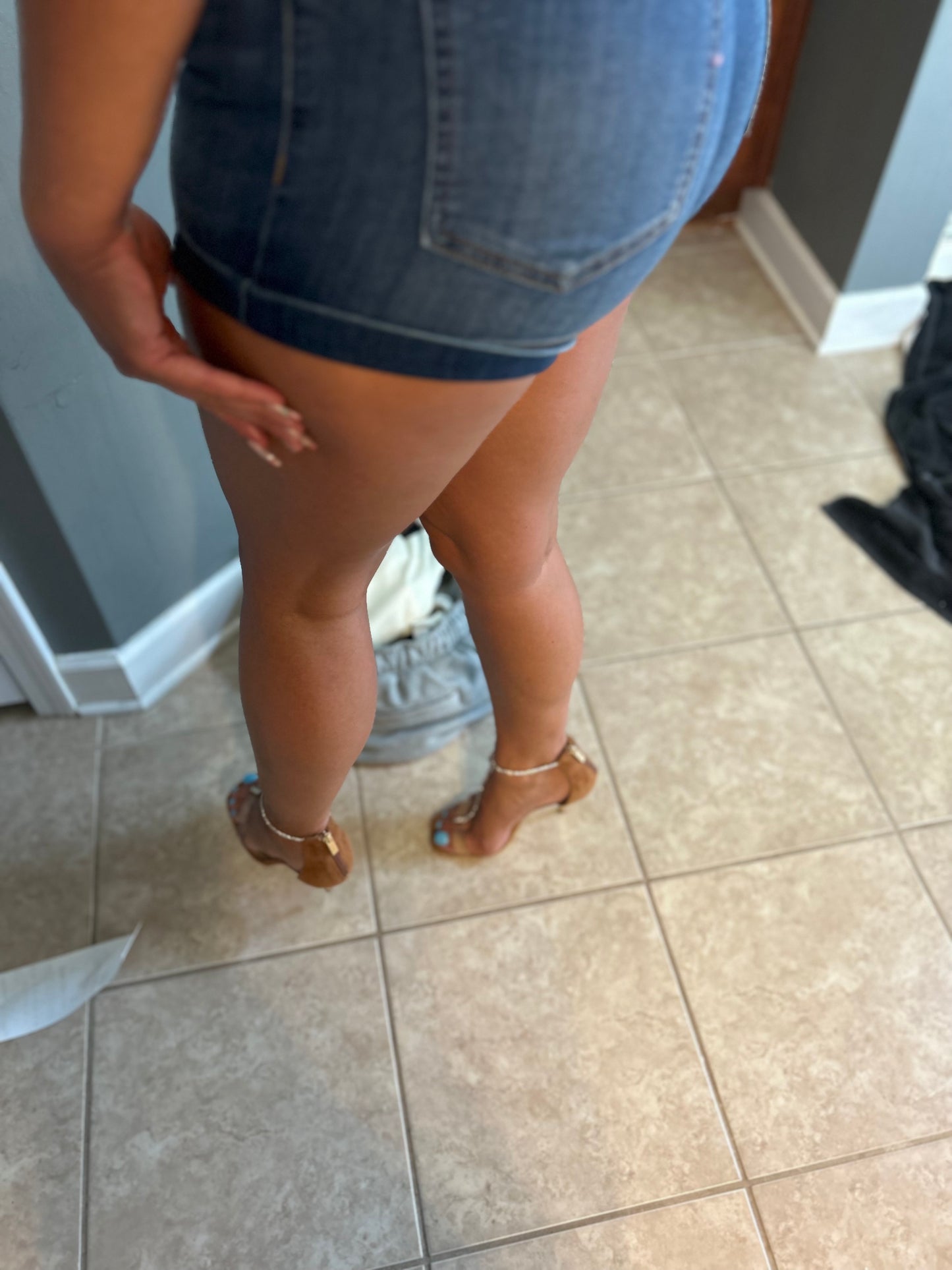 Bunions