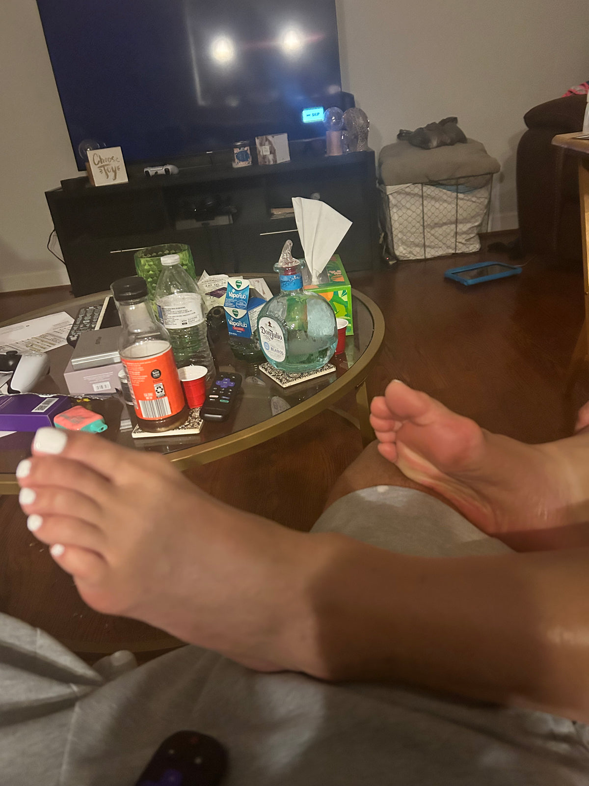 Bunions