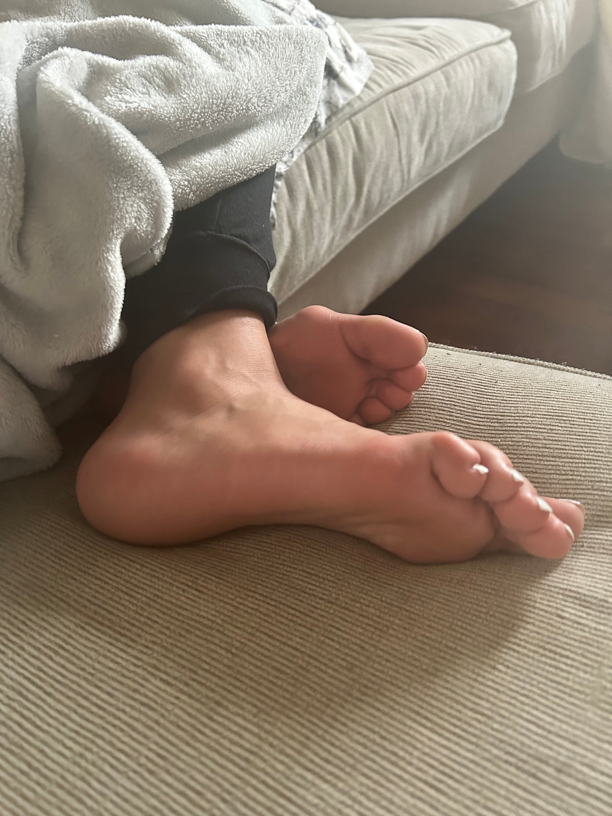 Bunions