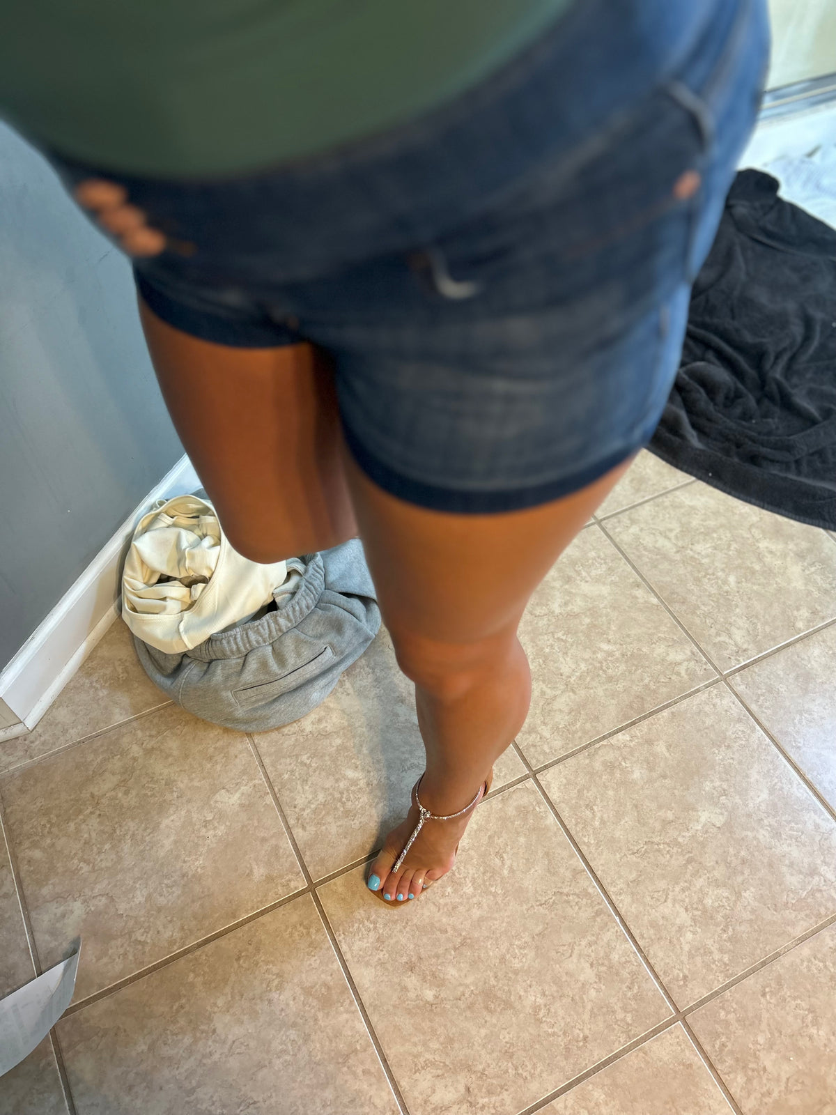 Bunions