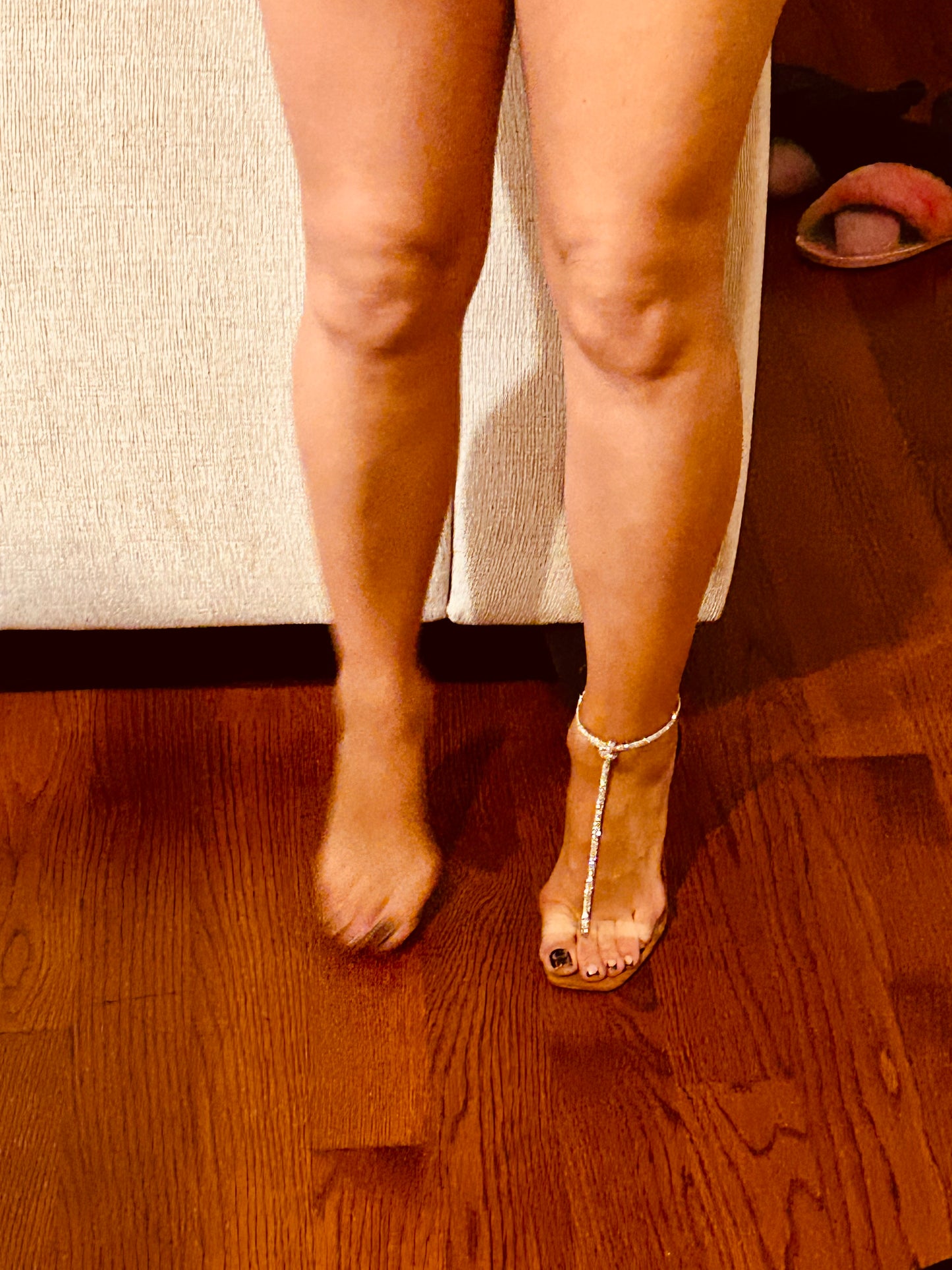 Bunions