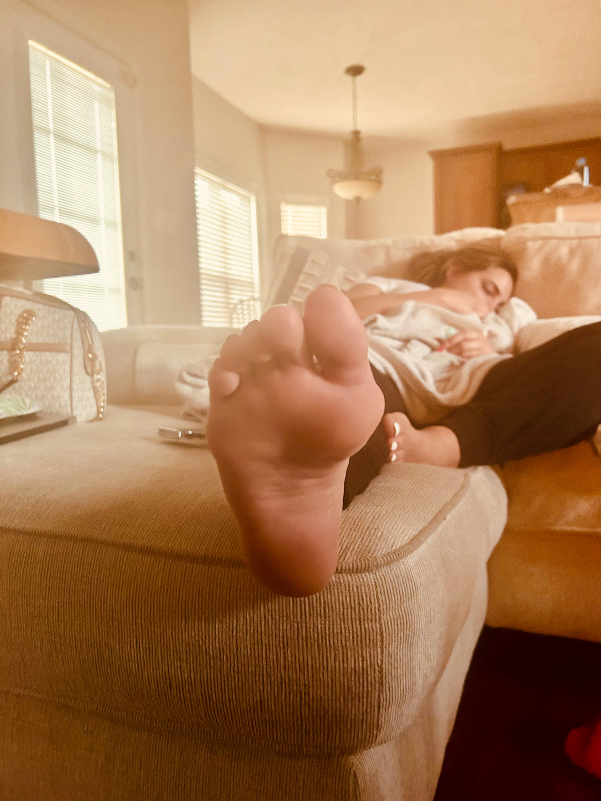 Bunions