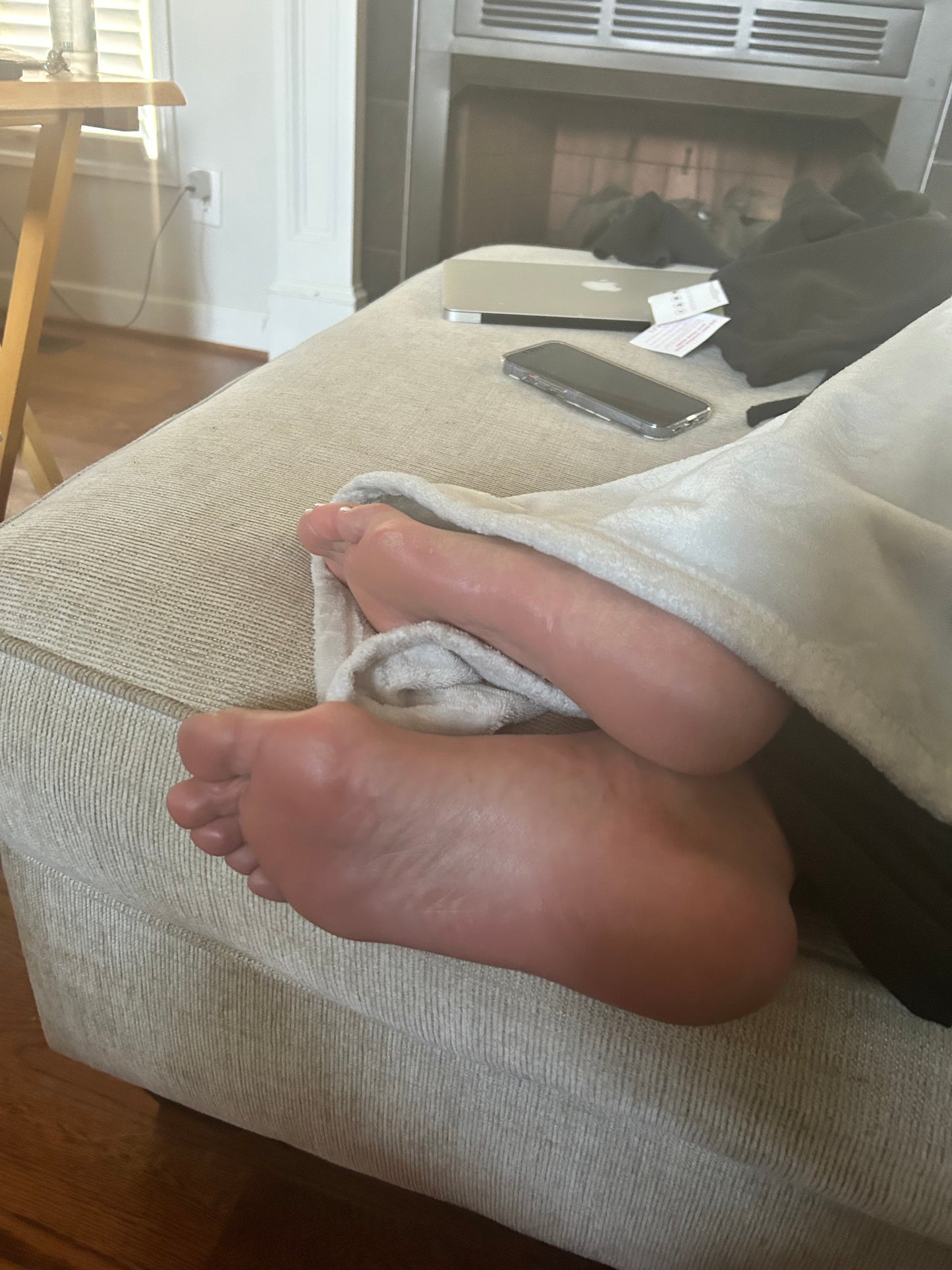 Bunions