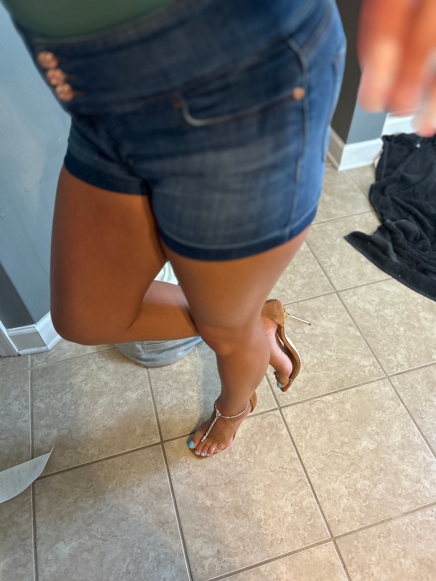 Bunions