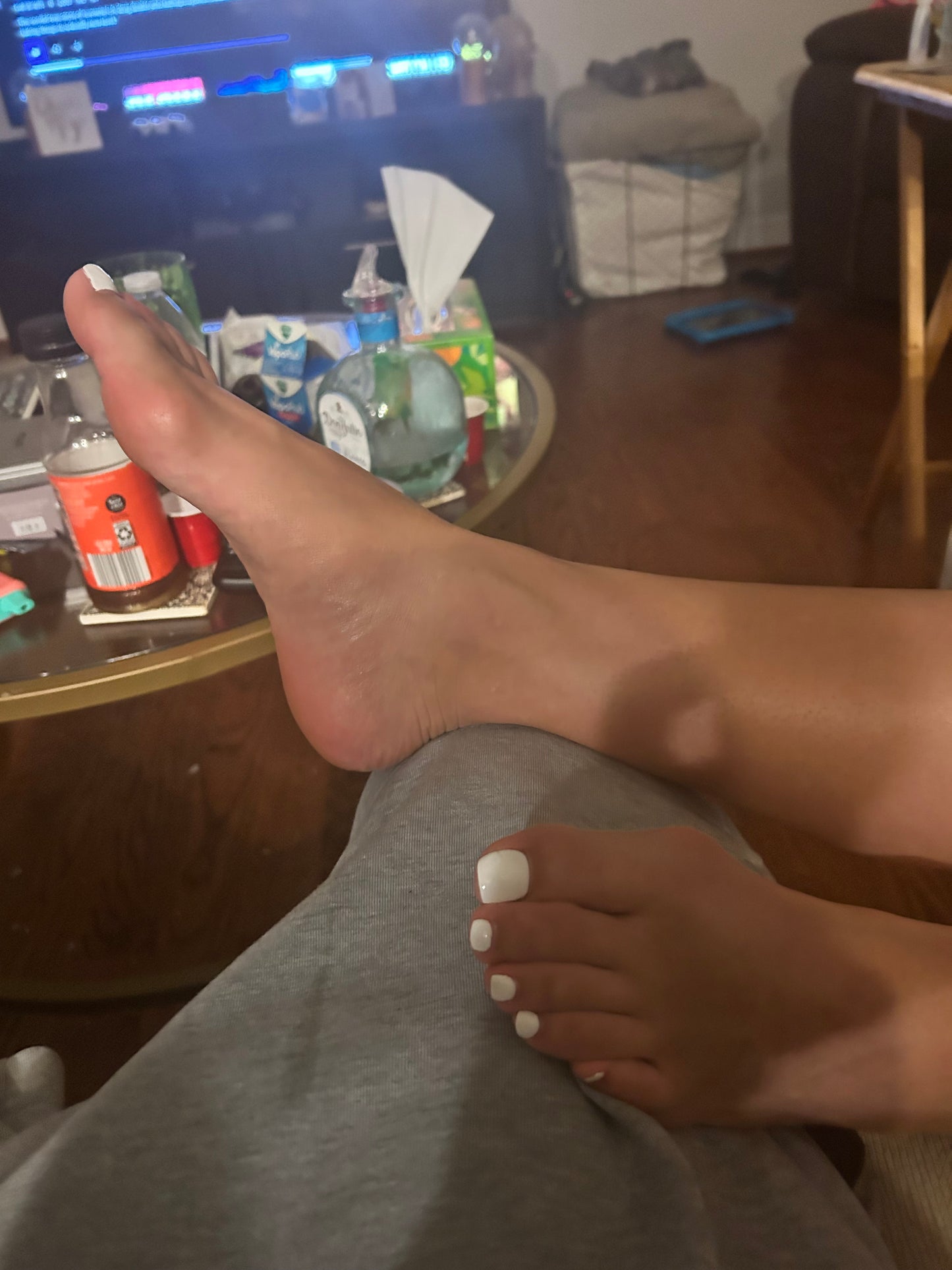 Bunions