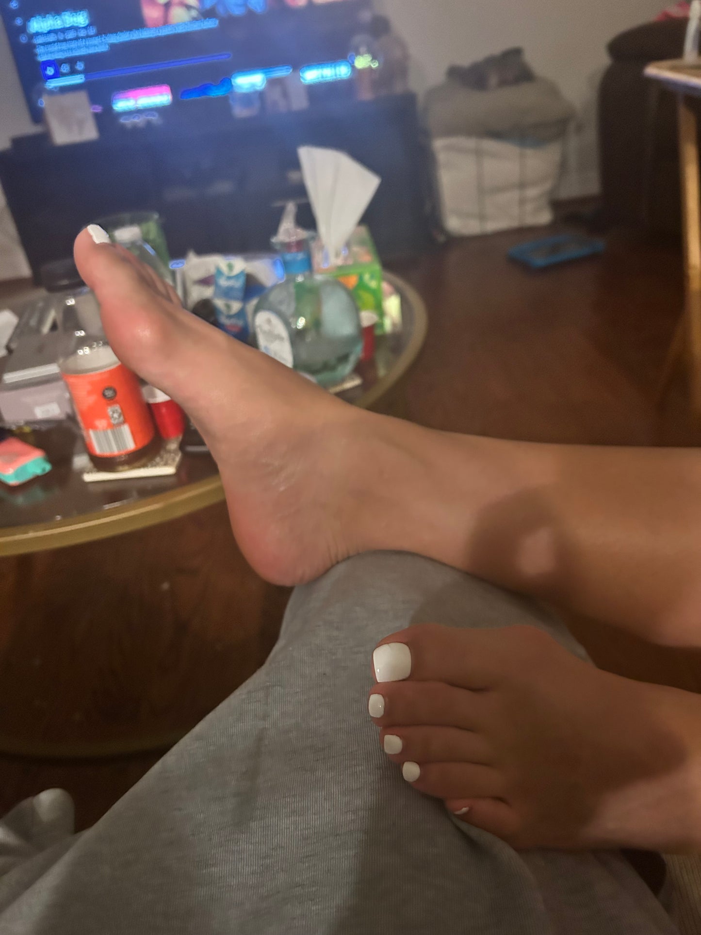 Bunions