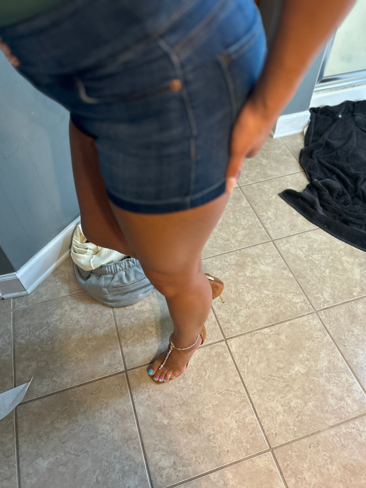 Bunions