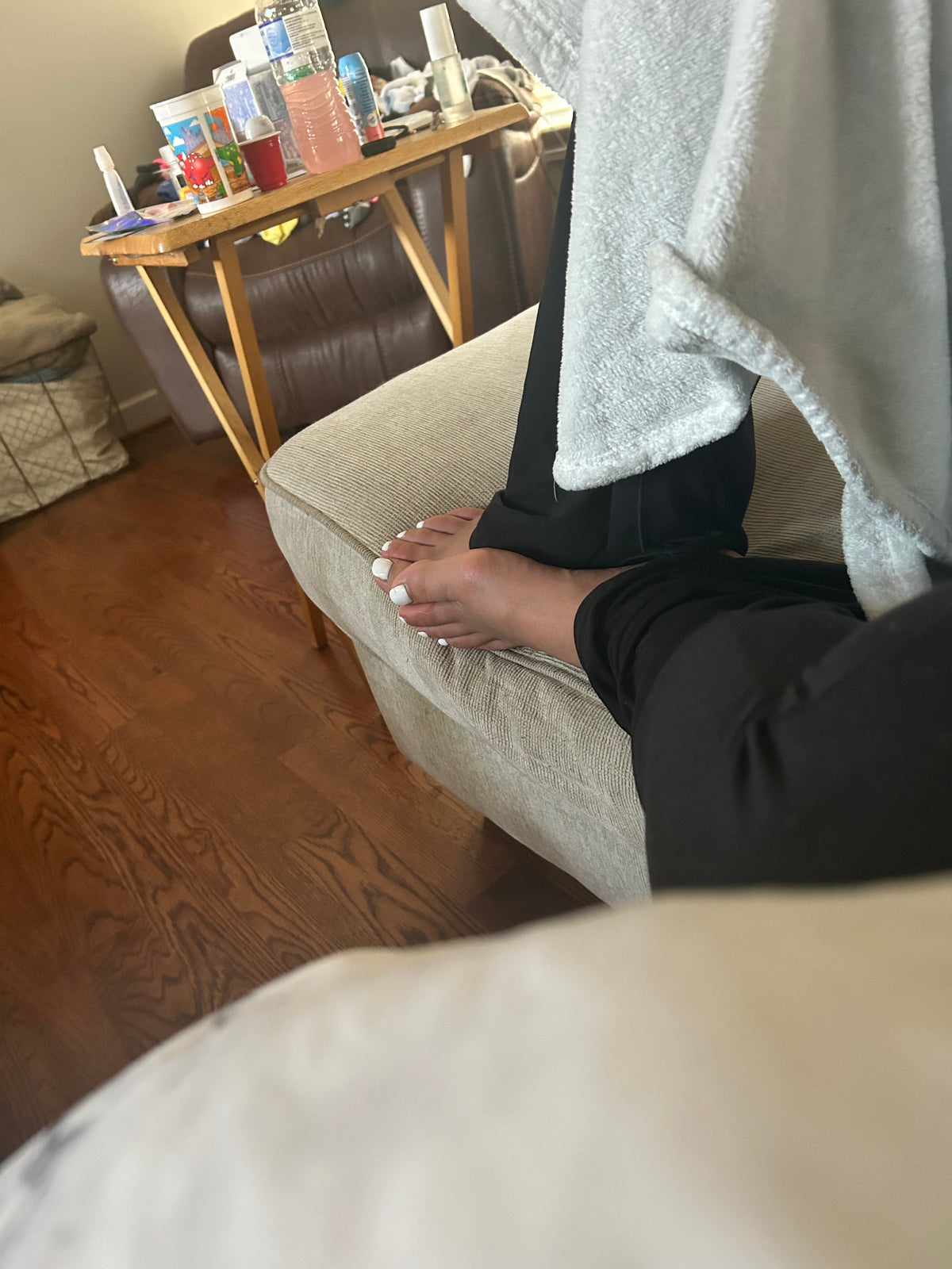 Bunions