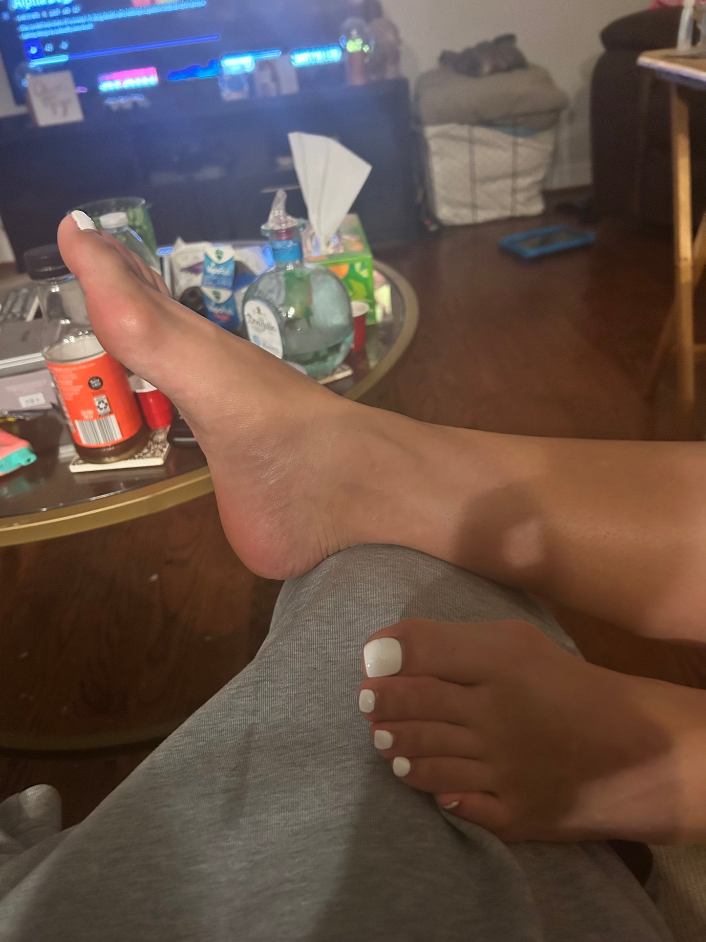 Bunions