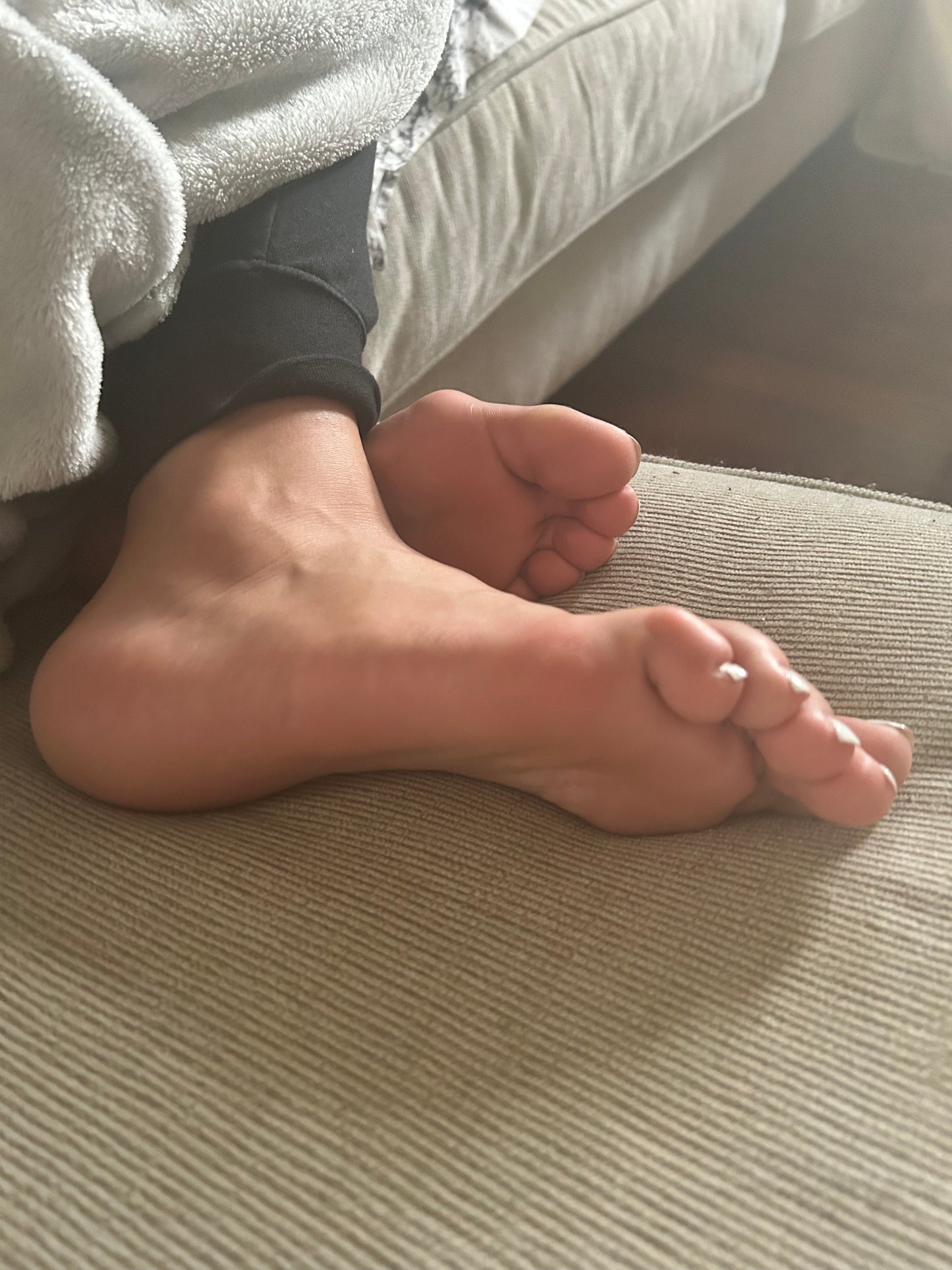 Bunions