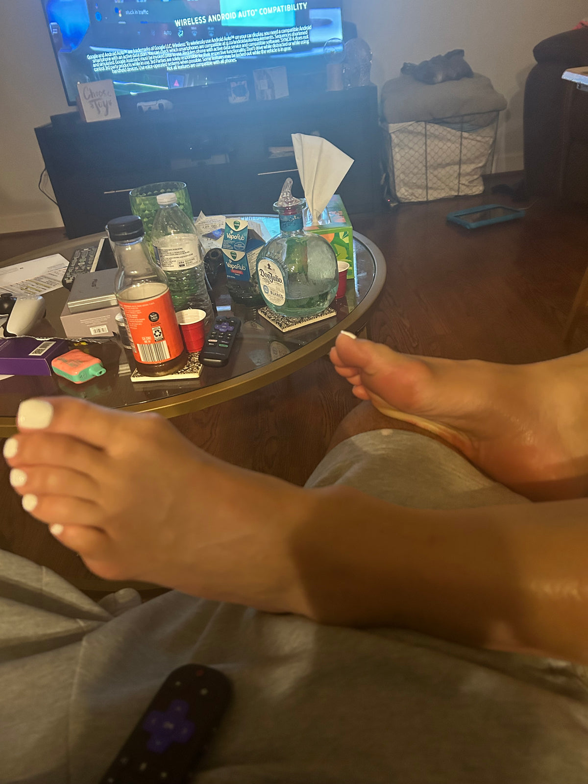 Bunions