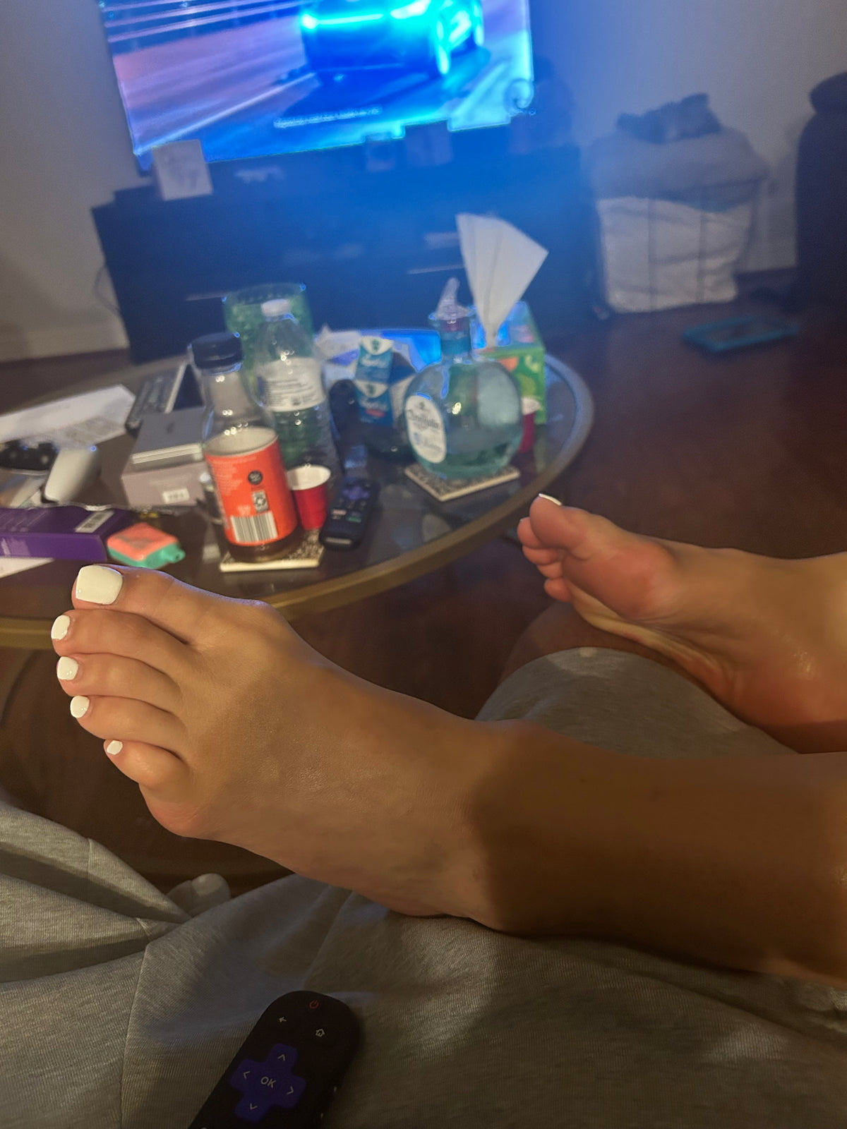Bunions