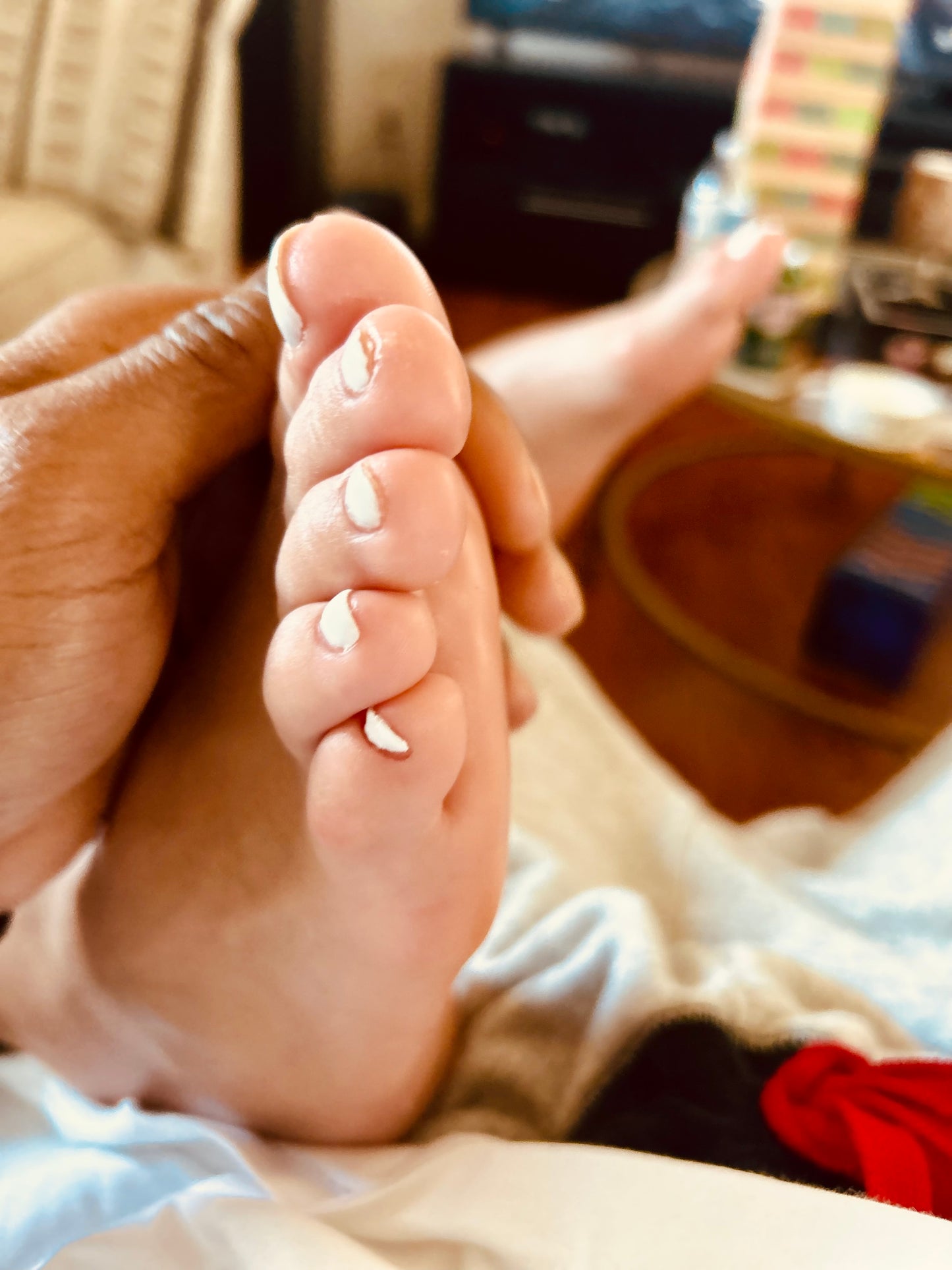 Bunions