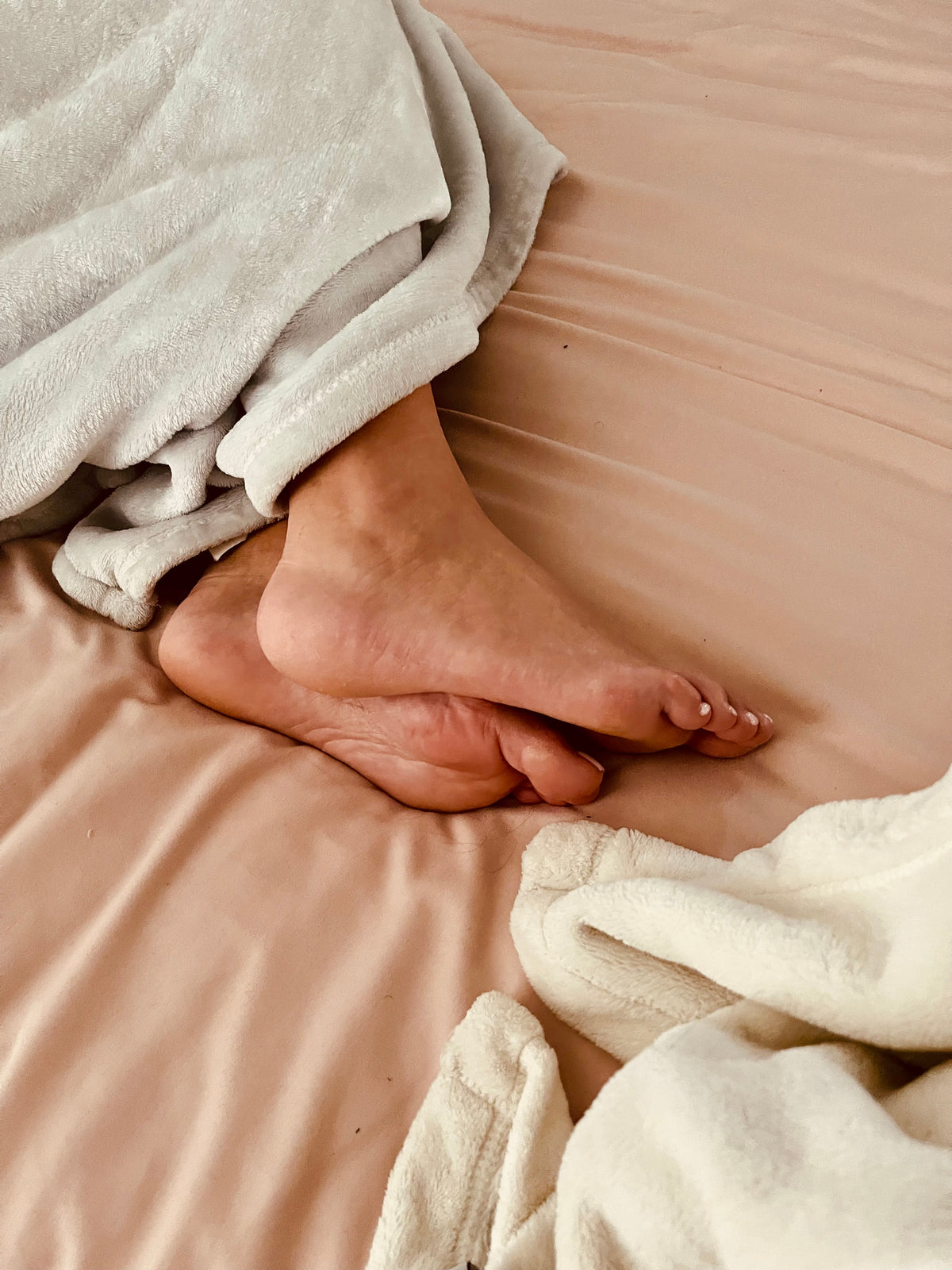Bunions