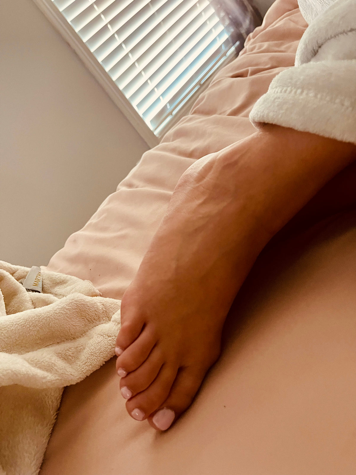 Bunions