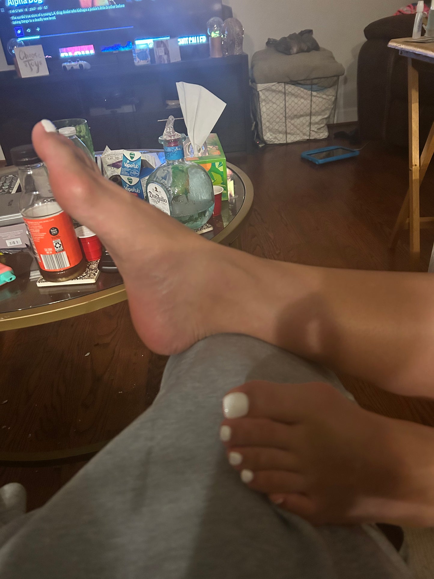 Bunions