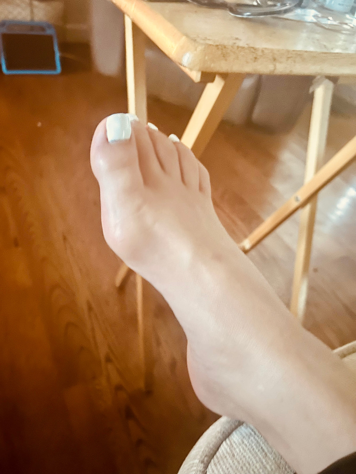 Bunions