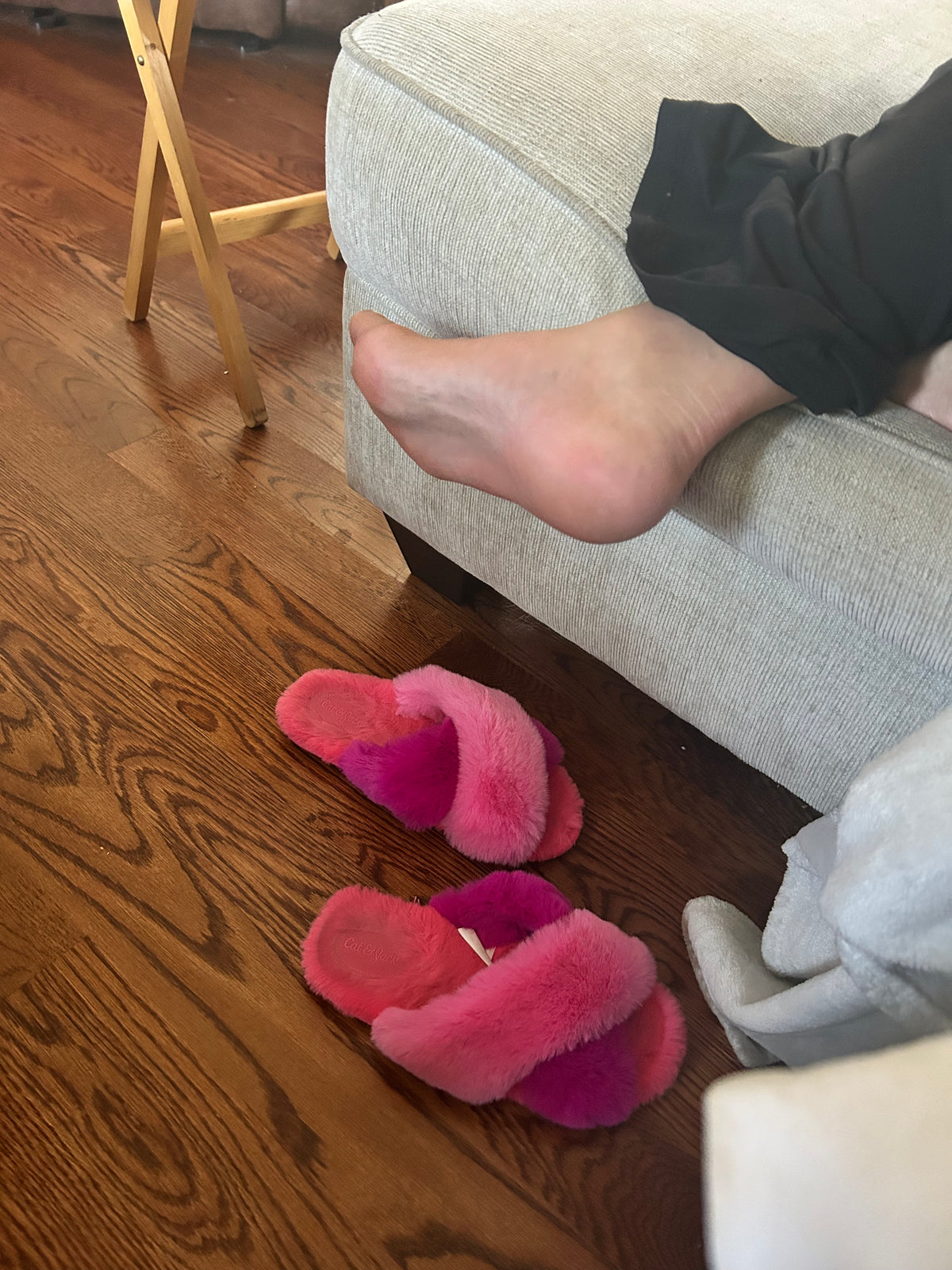 Bunions