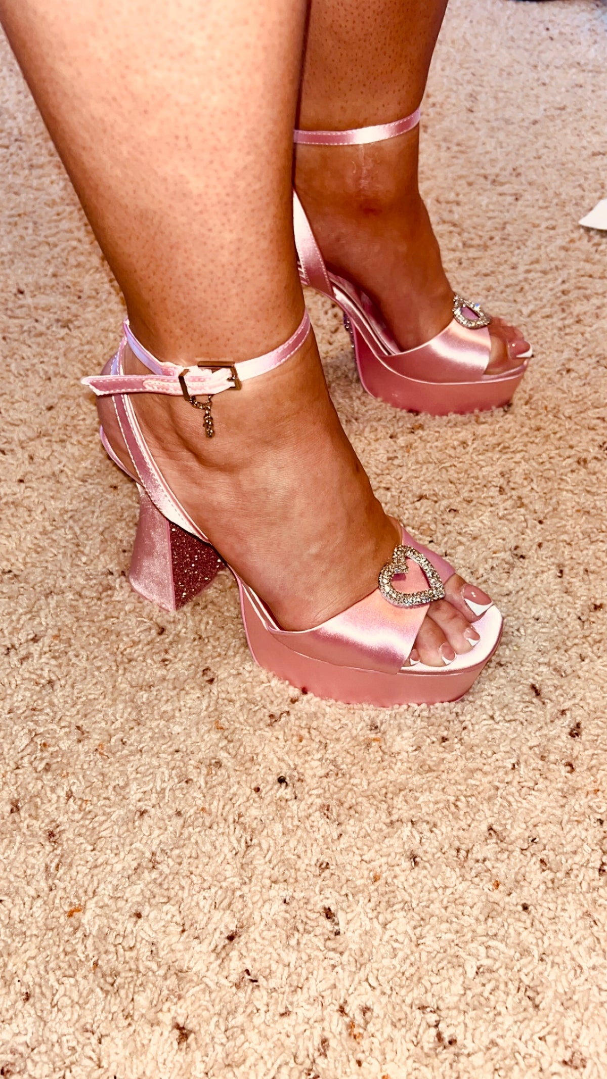 Bunions