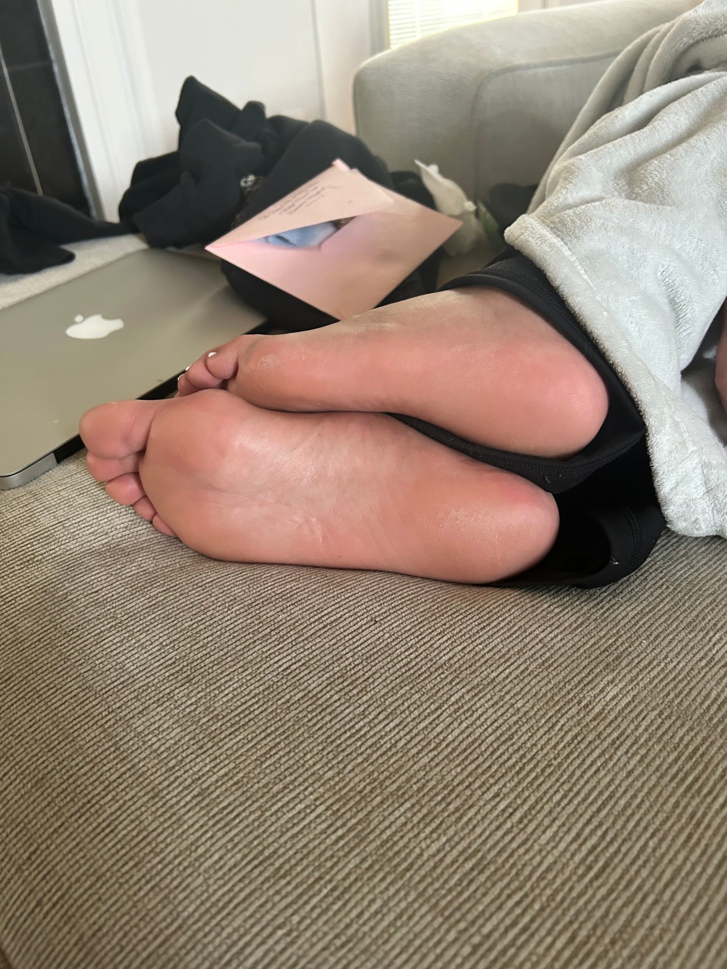 Bunions