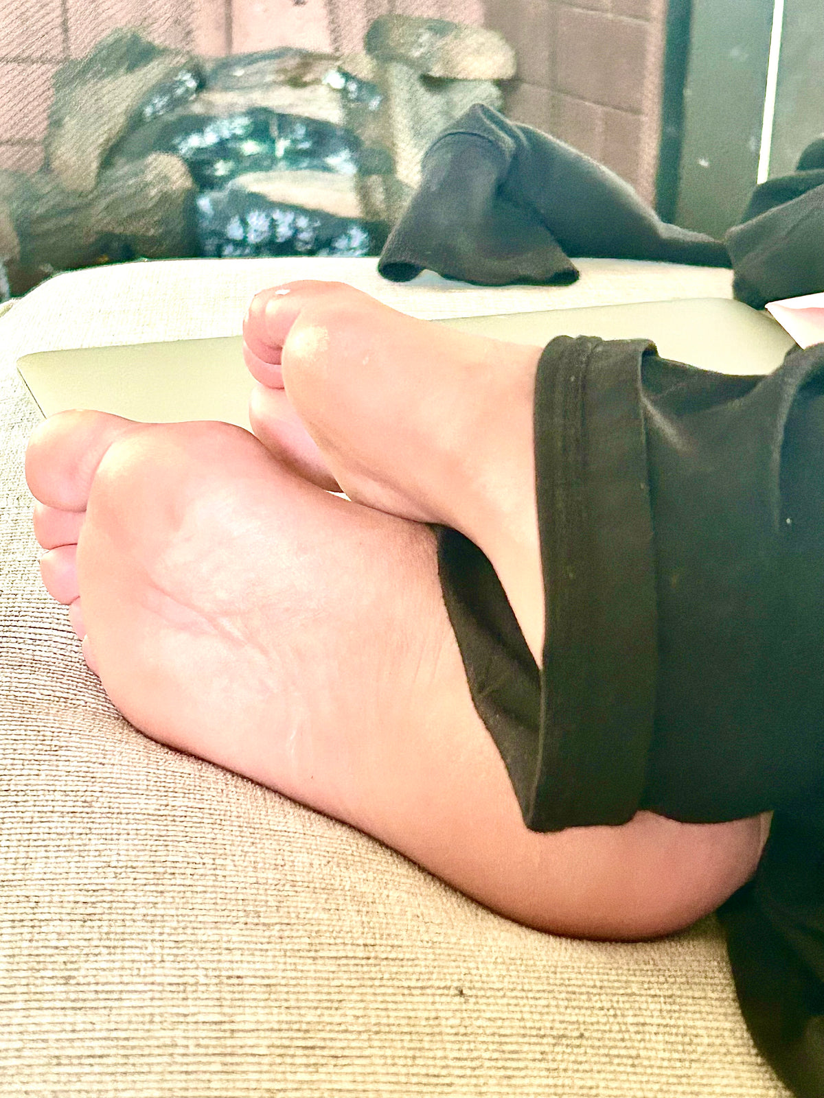 Bunions