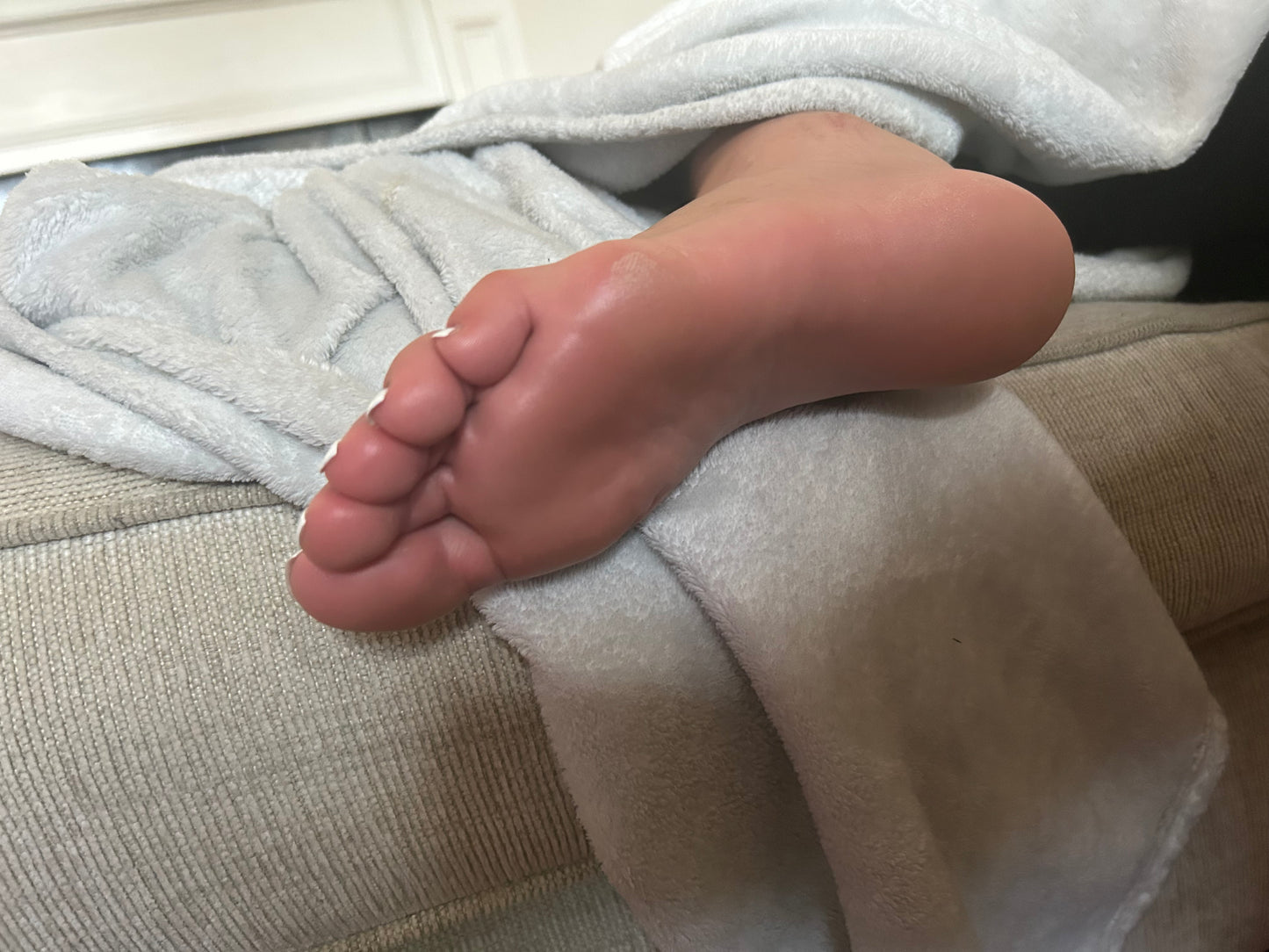 Bunions