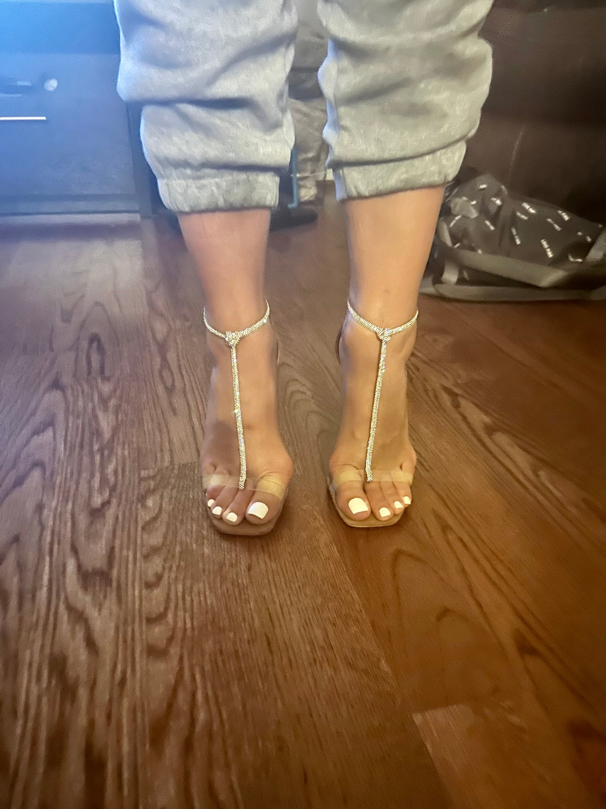 Bunions
