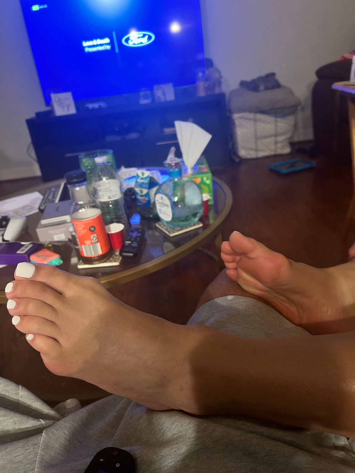 Bunions