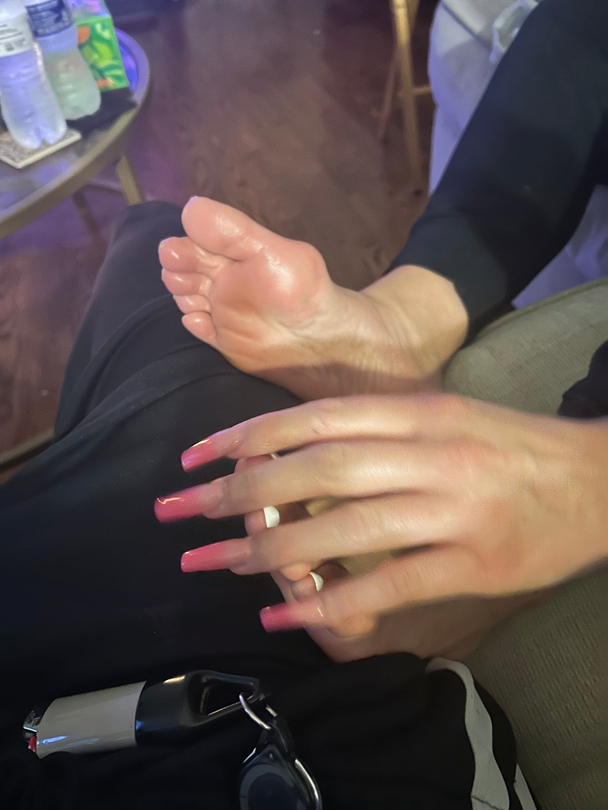 Bunions