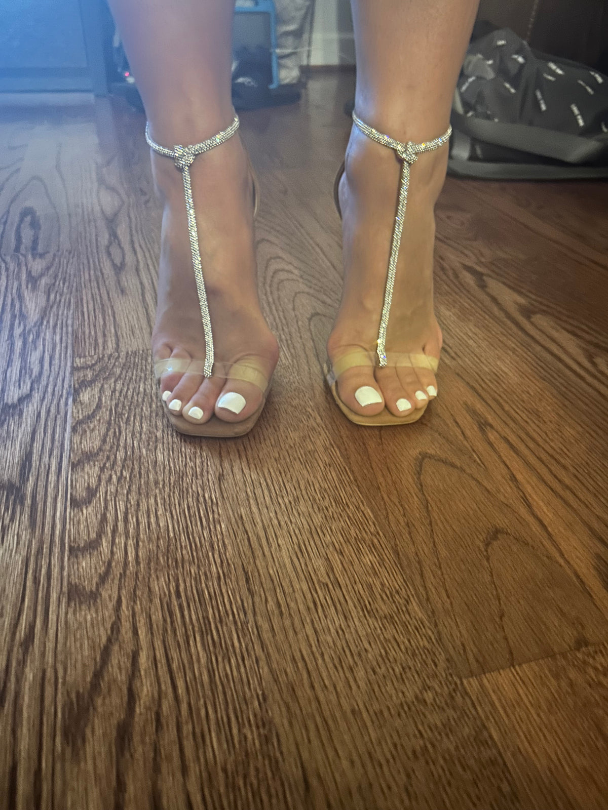 Bunions