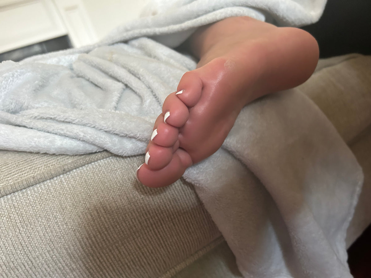 Bunions