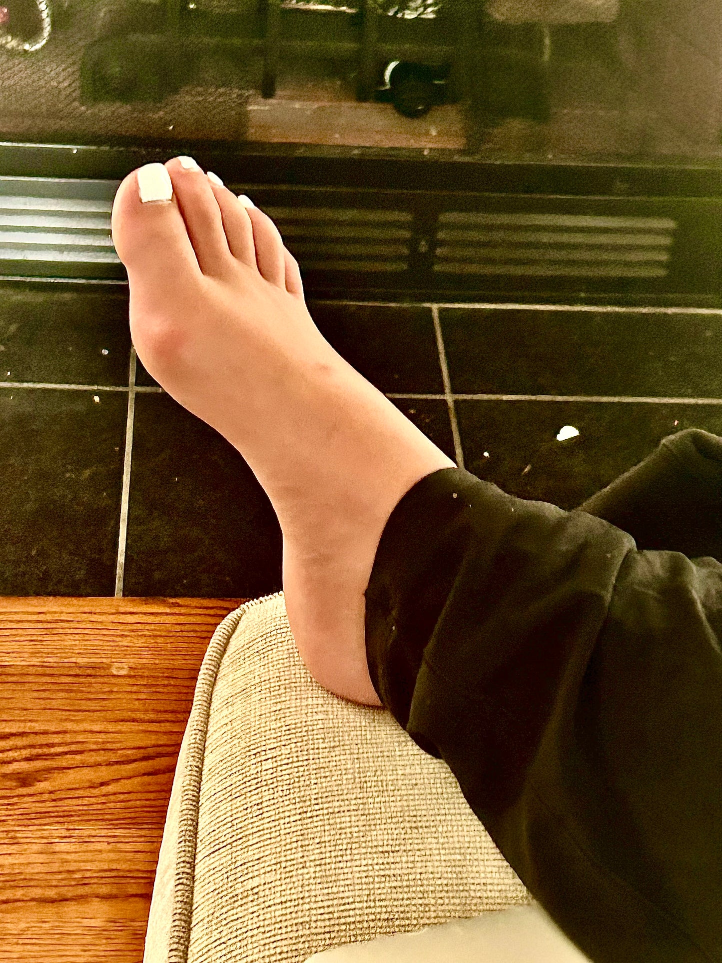 Bunions