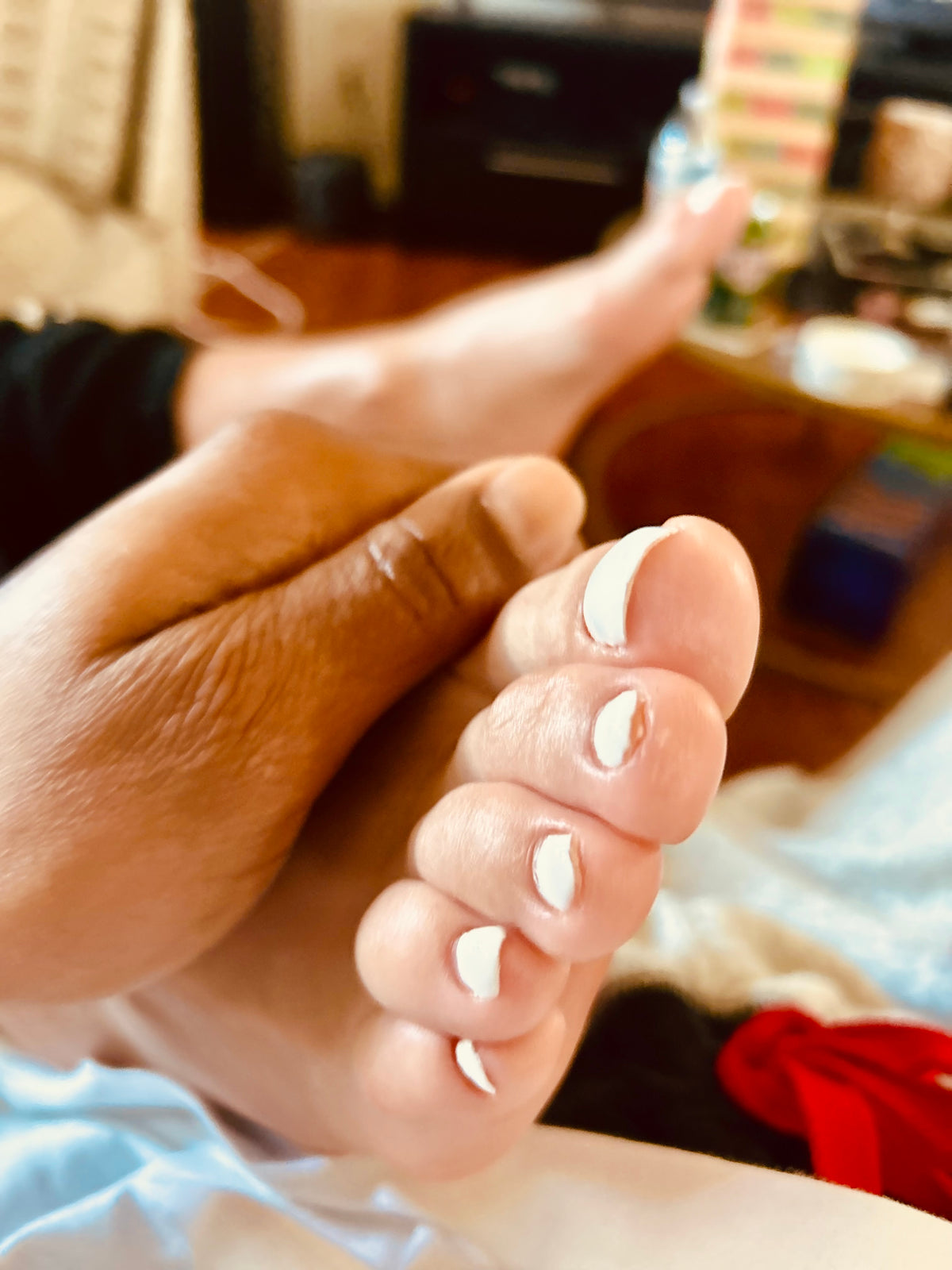 Bunions