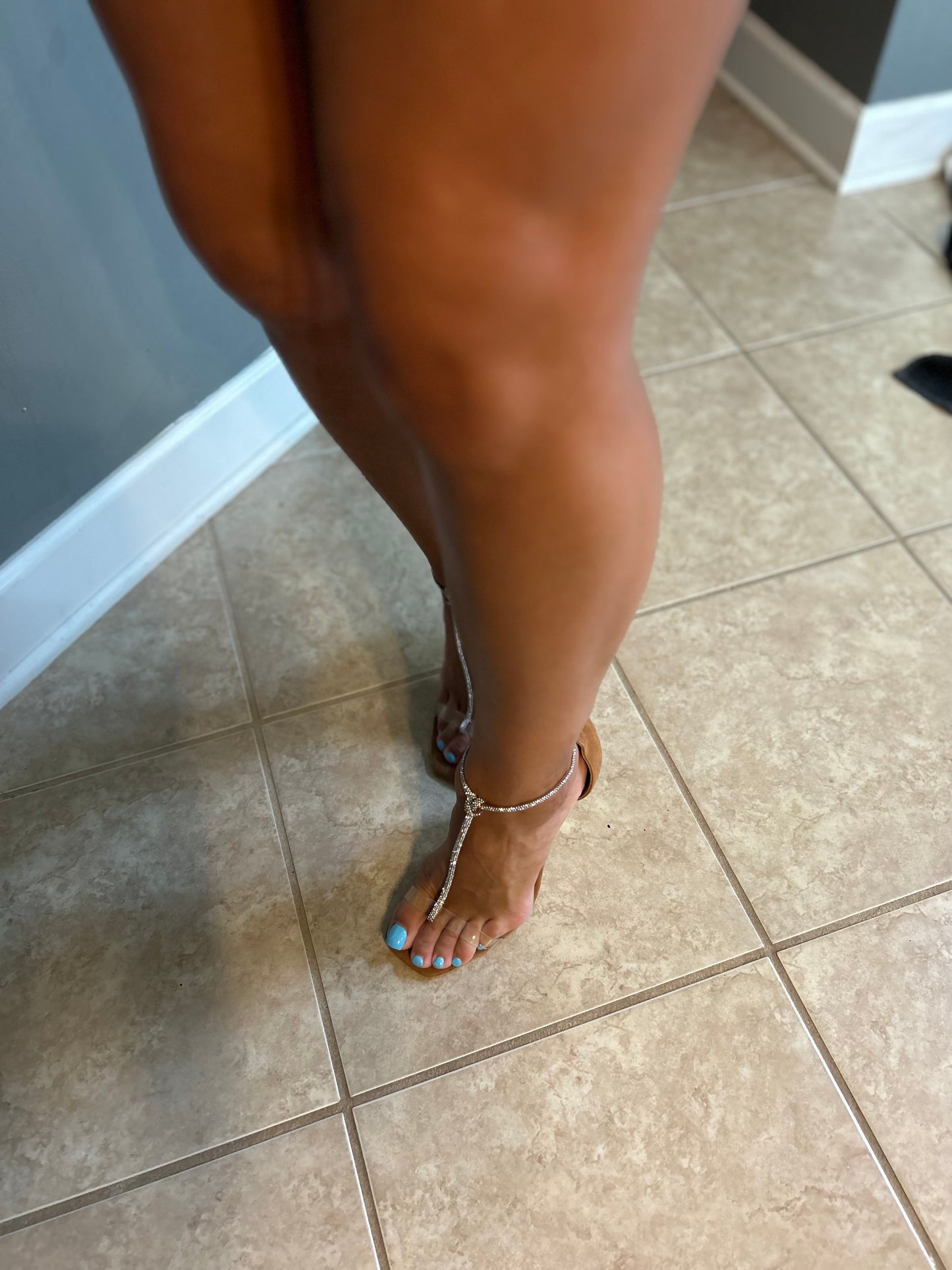 Bunions