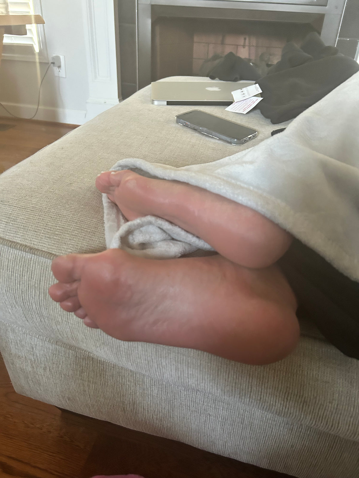 Bunions