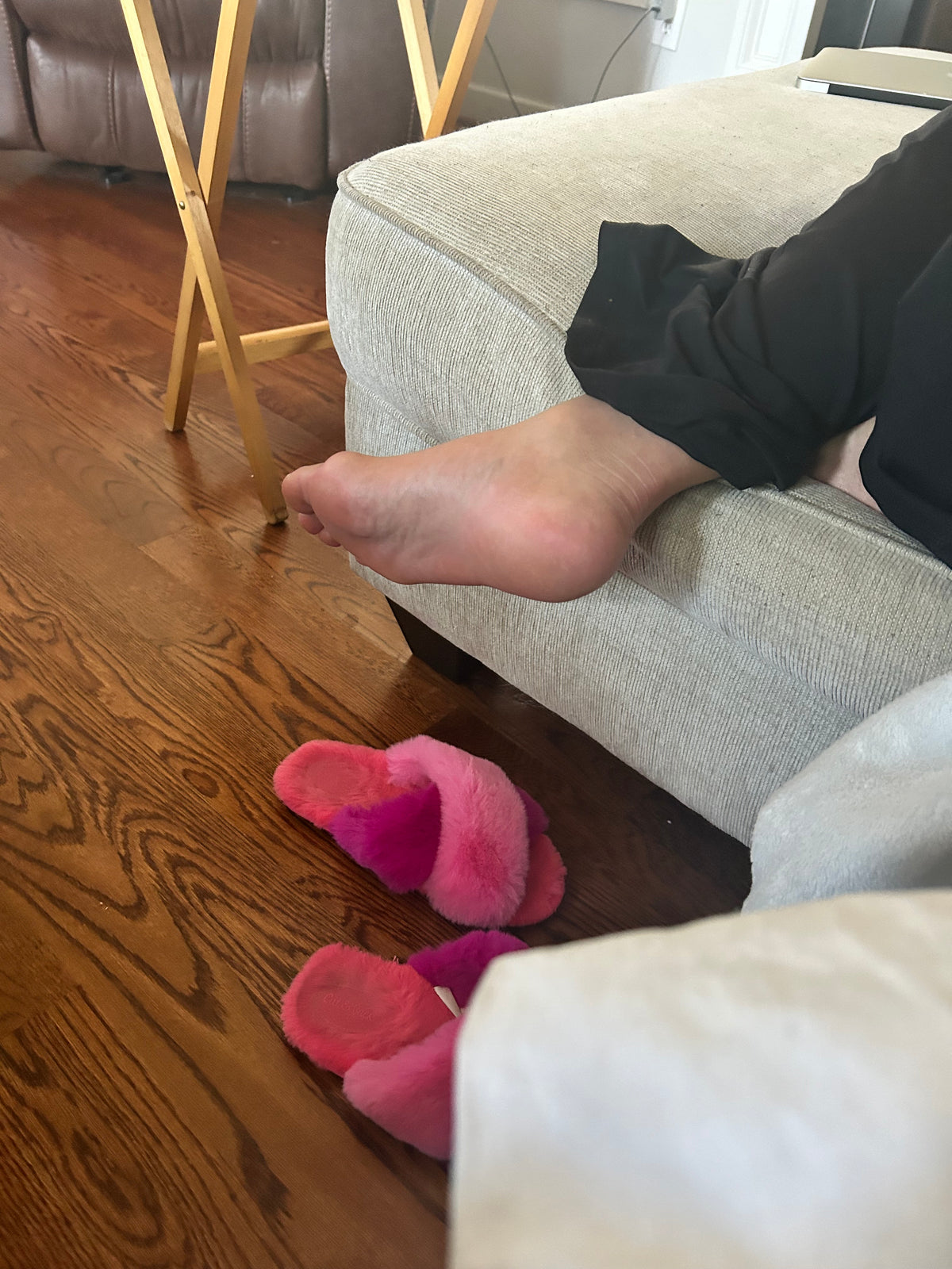 Bunions
