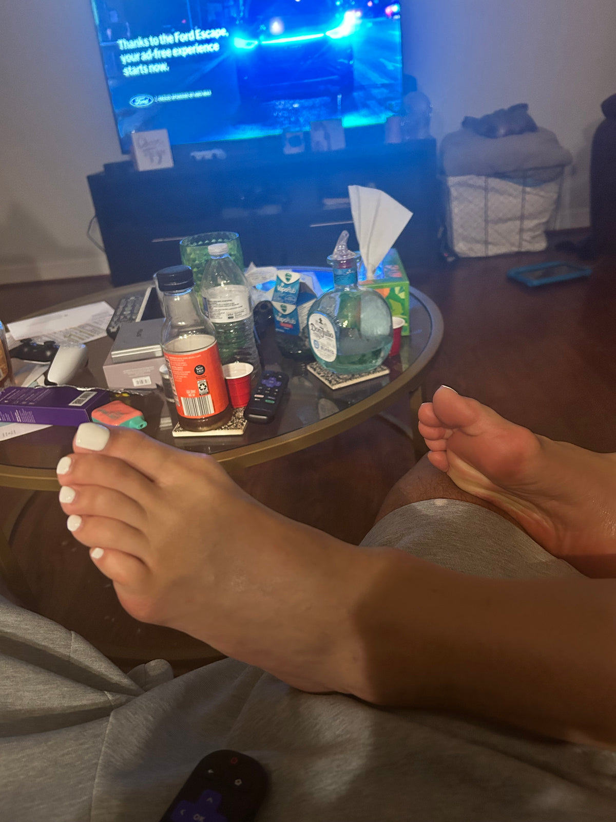 Bunions