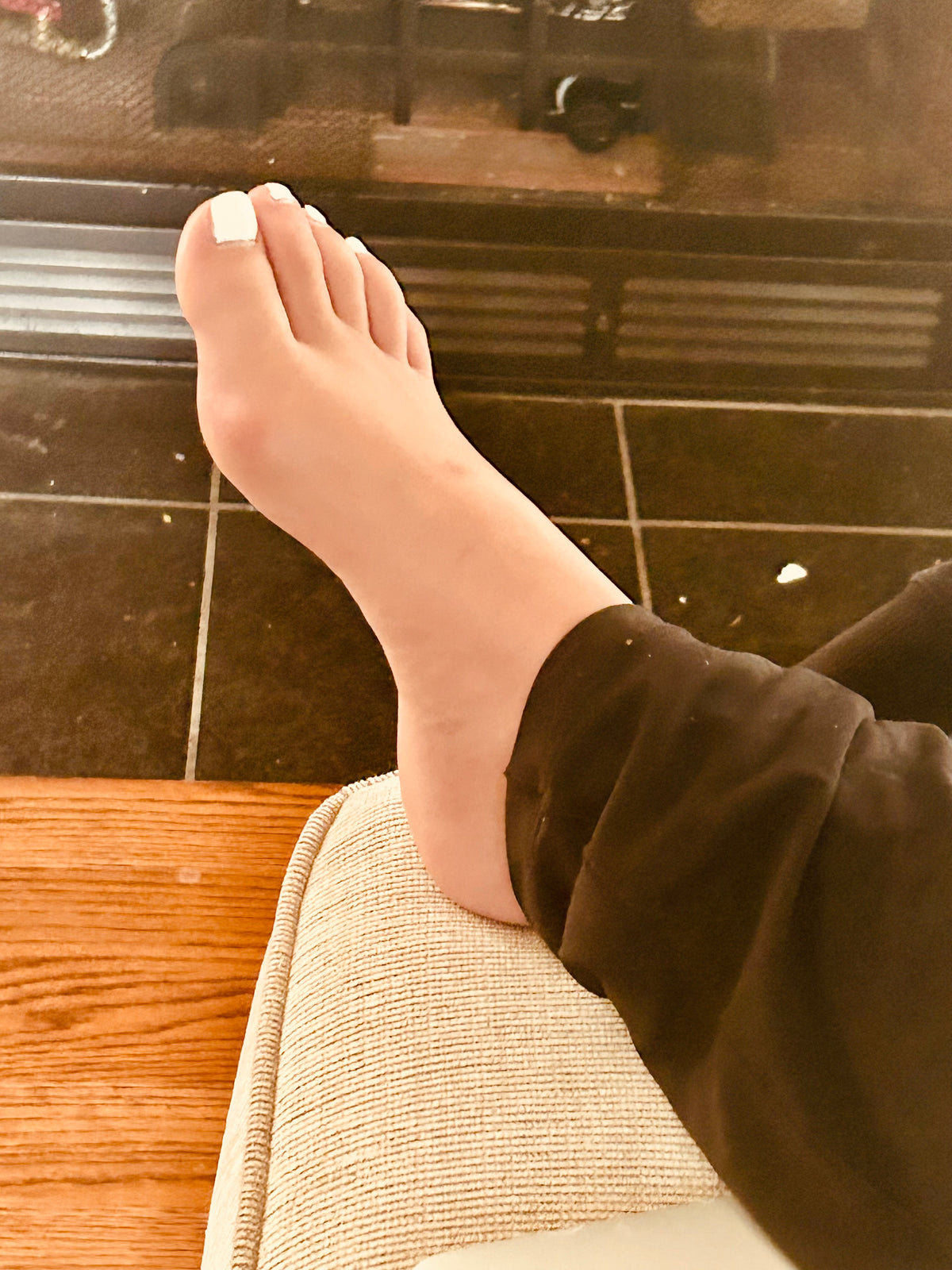 Bunions