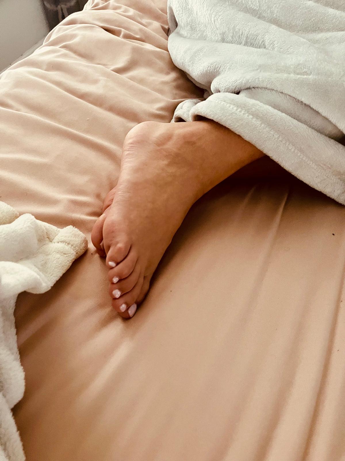 Bunions