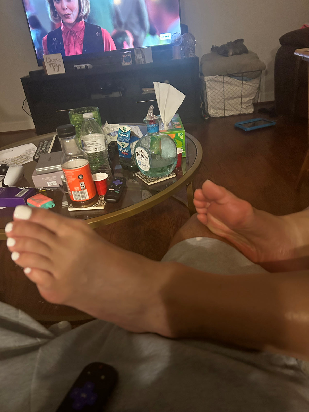Bunions
