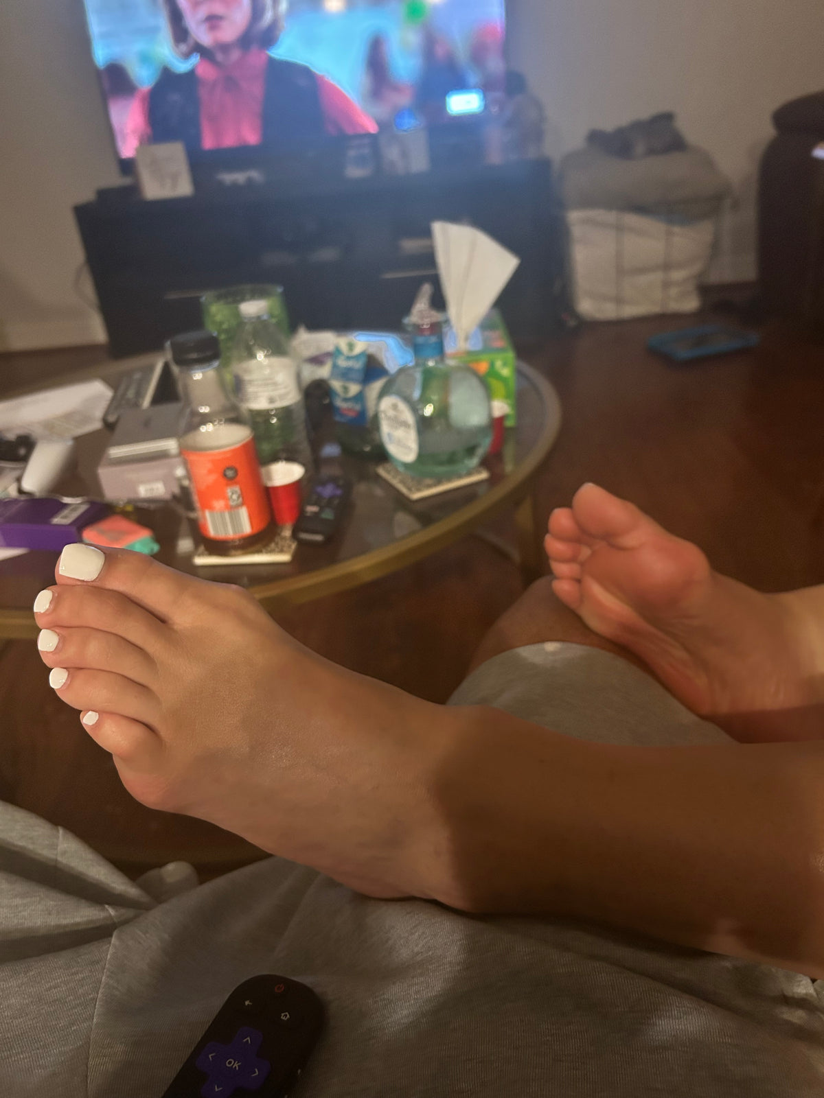 Bunions