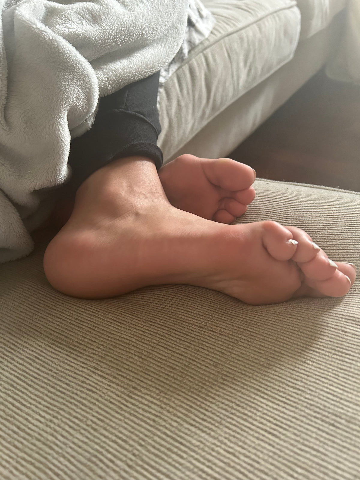 Bunions