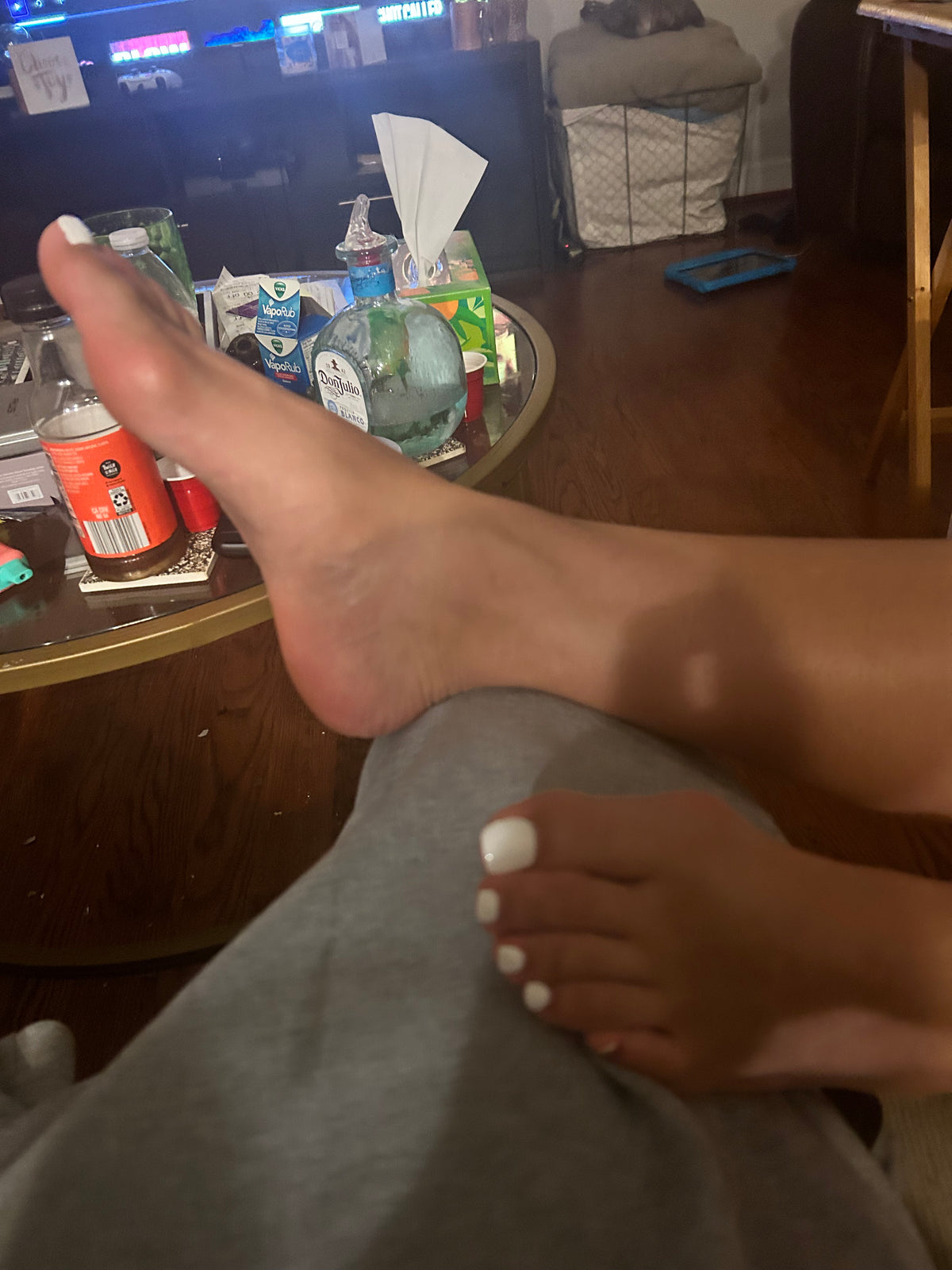 Bunions