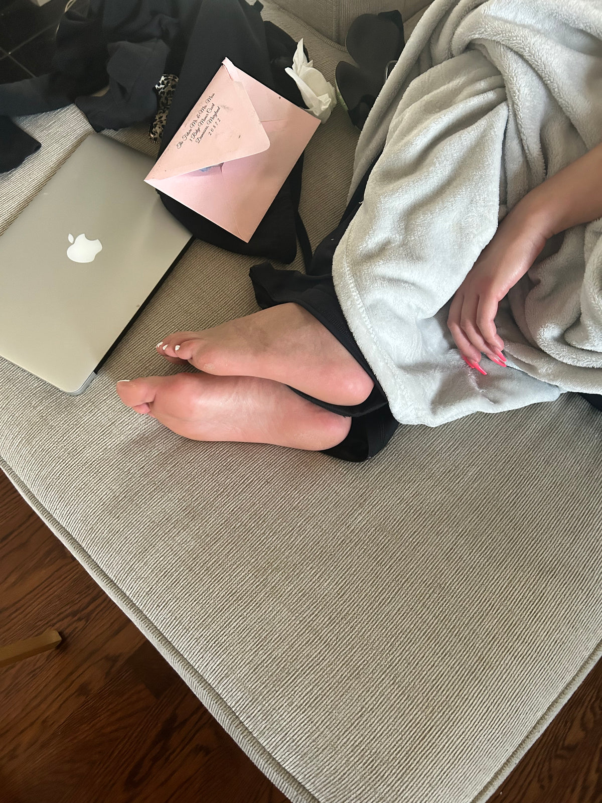 Bunions