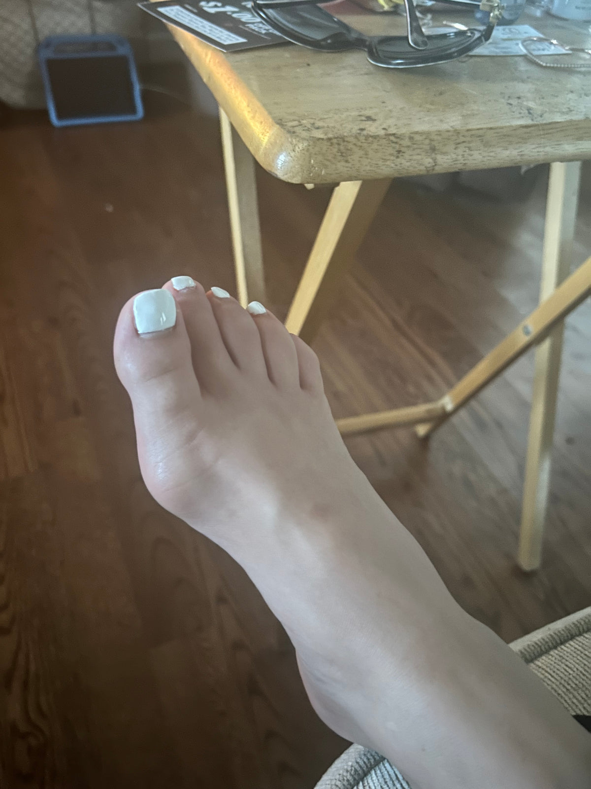 Bunions