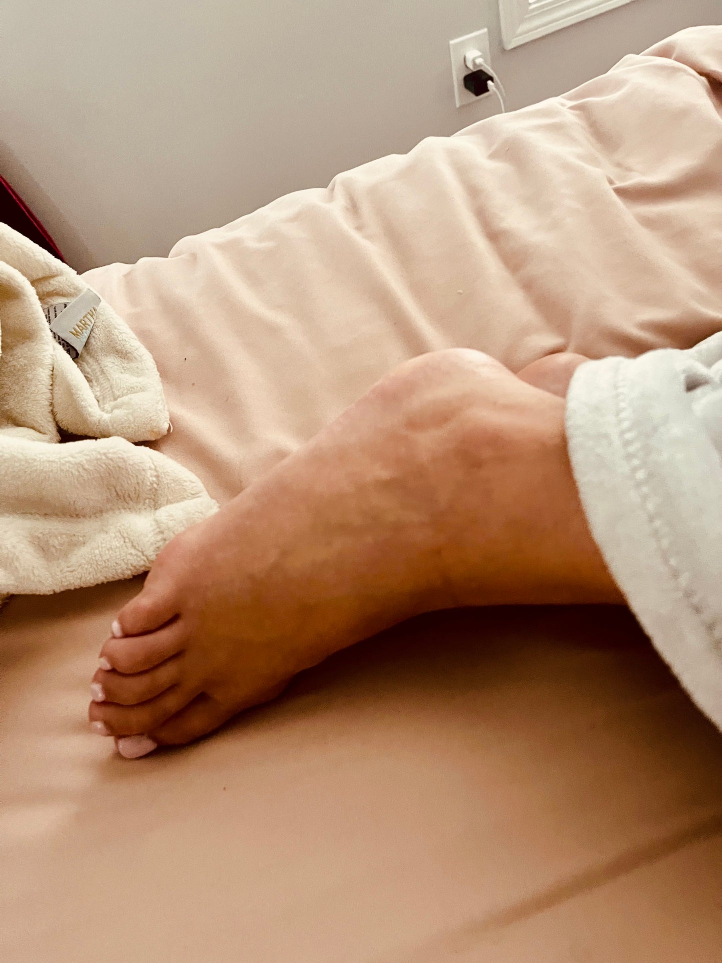 Bunions