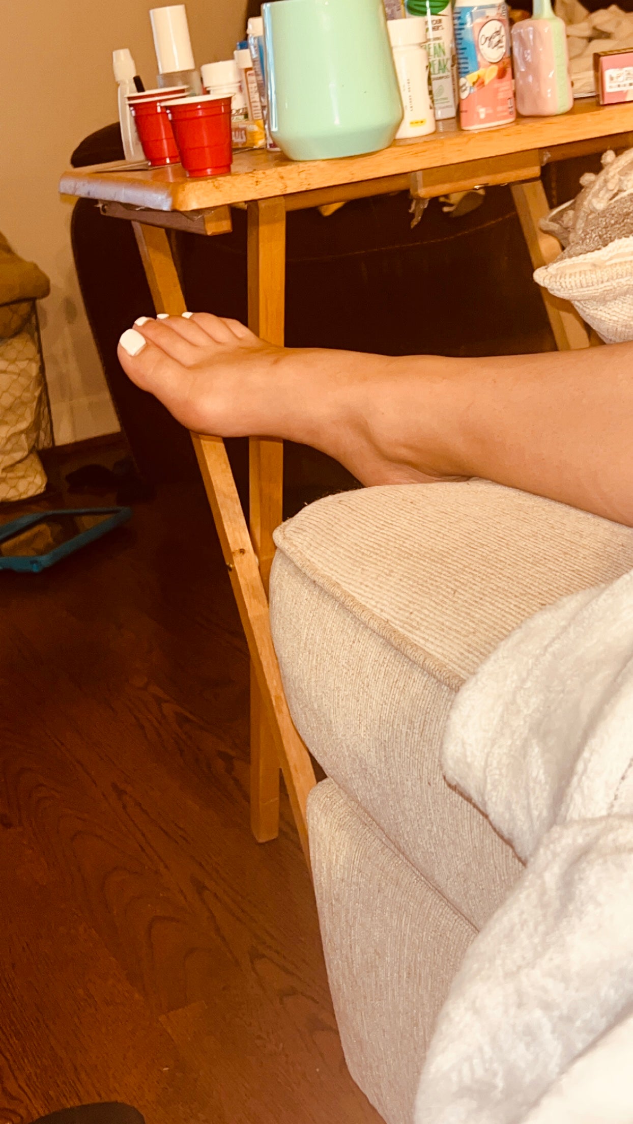 Bunions