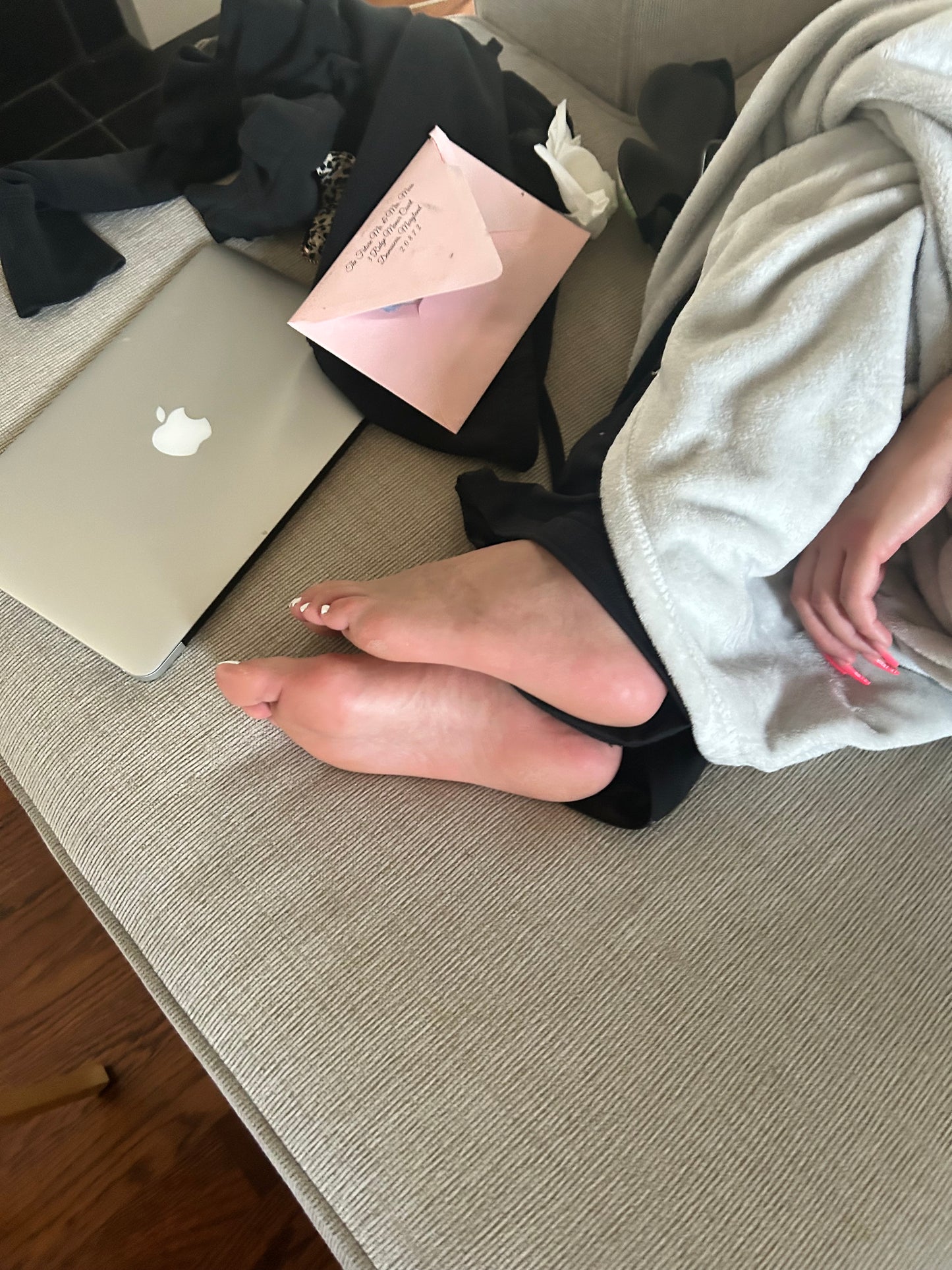 Bunions