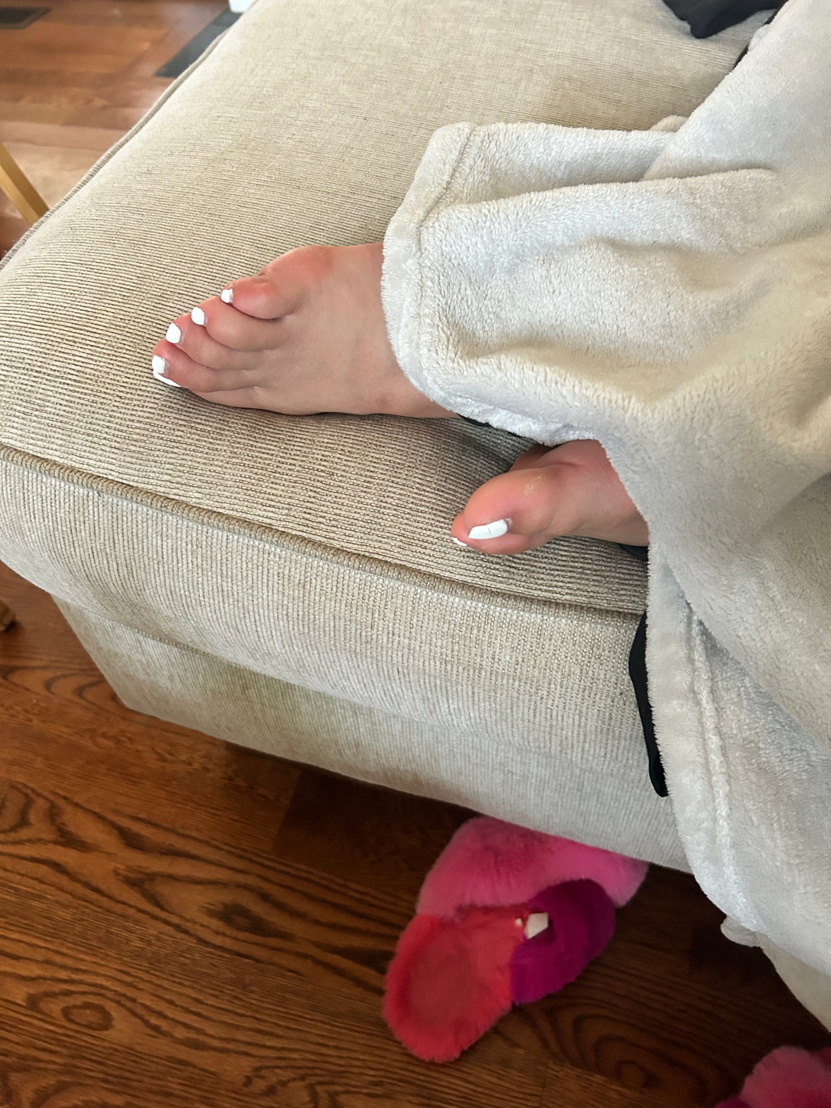 Bunions