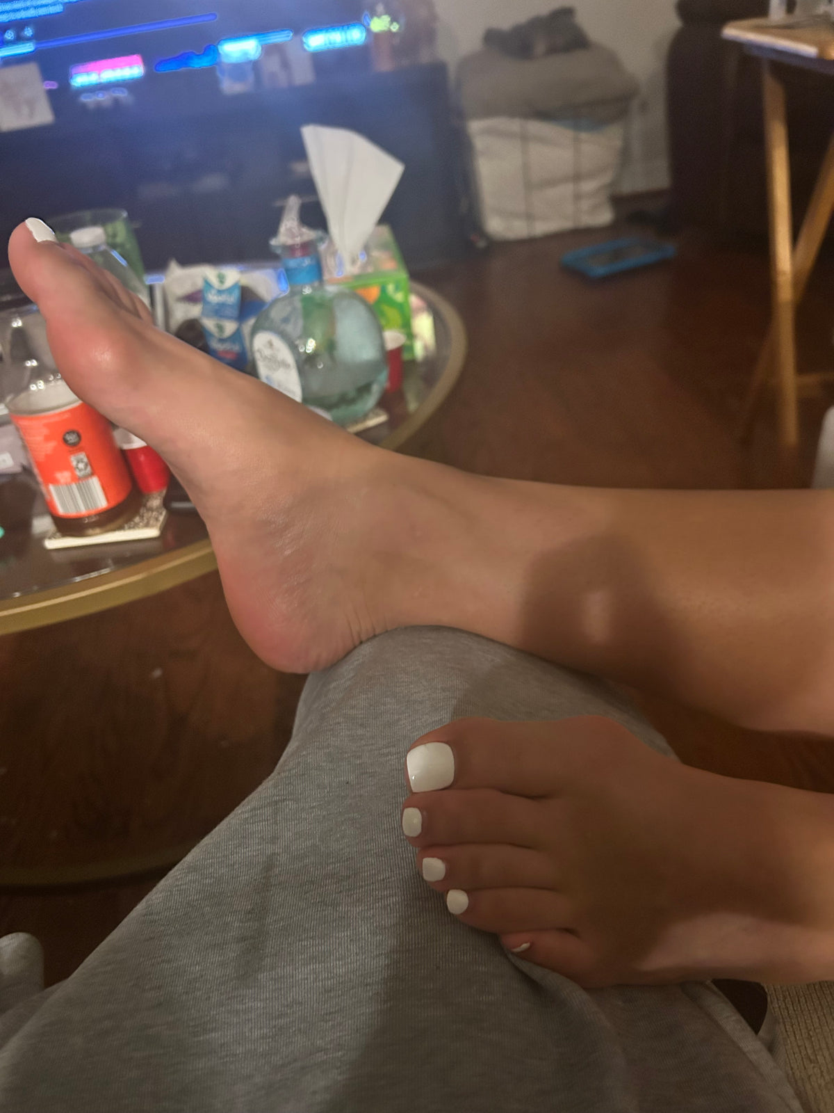 Bunions
